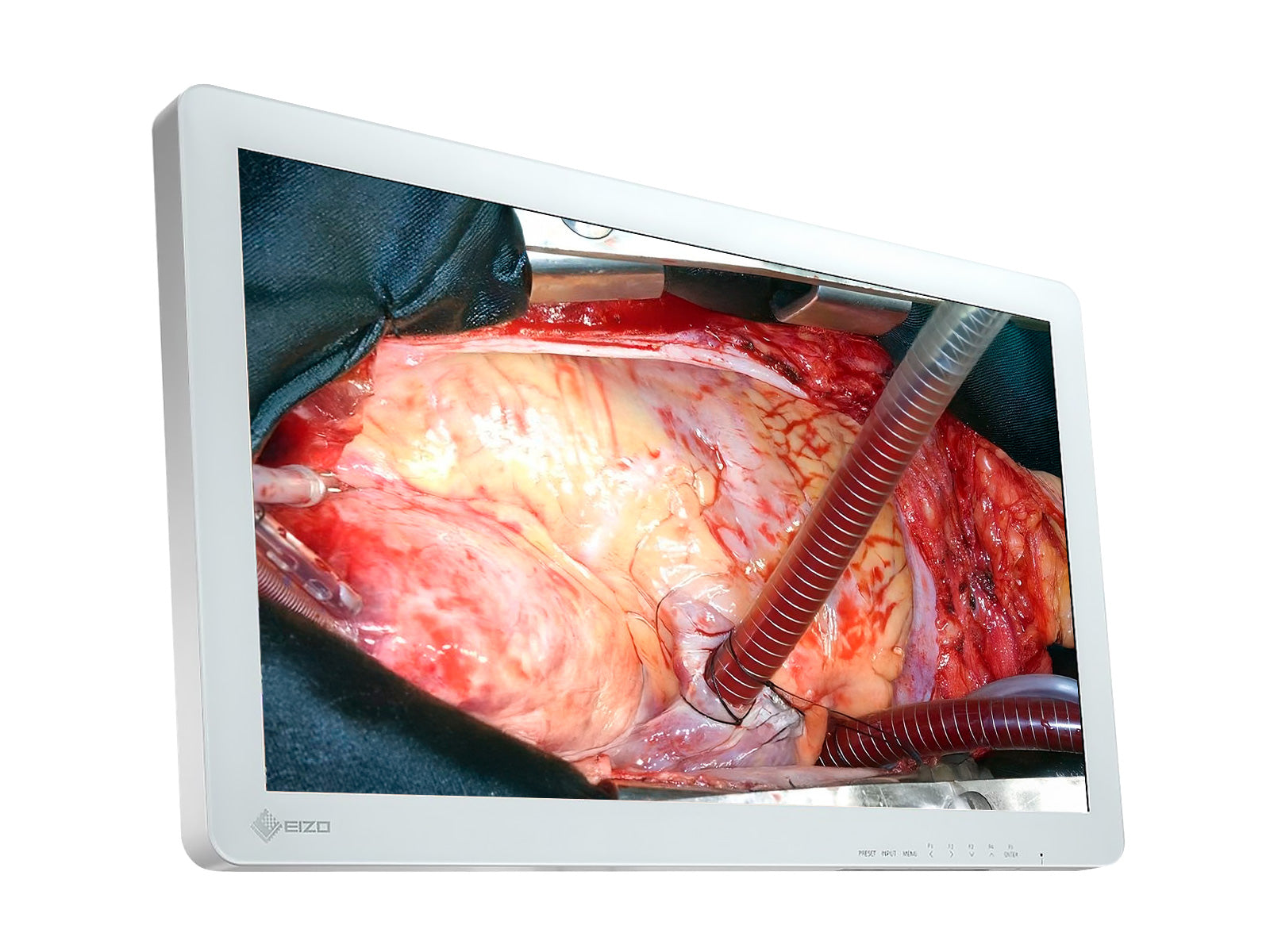 Monitor Médico Eizo EX2620 26" – Uso Quirúrgico DICOM (3)