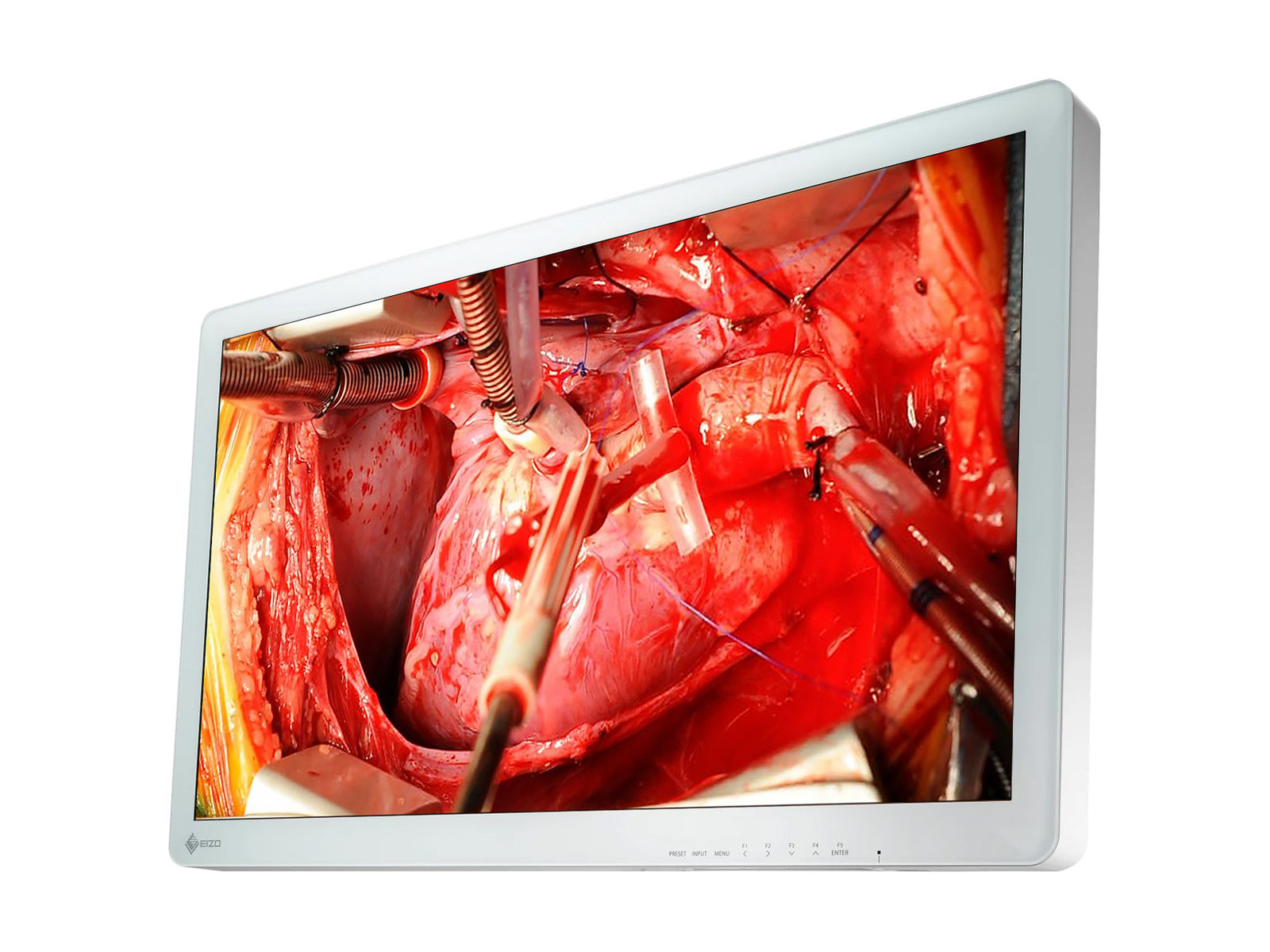 Monitor Médico Eizo EX2621 26" – Uso Quirúrgico DICOM (2)
