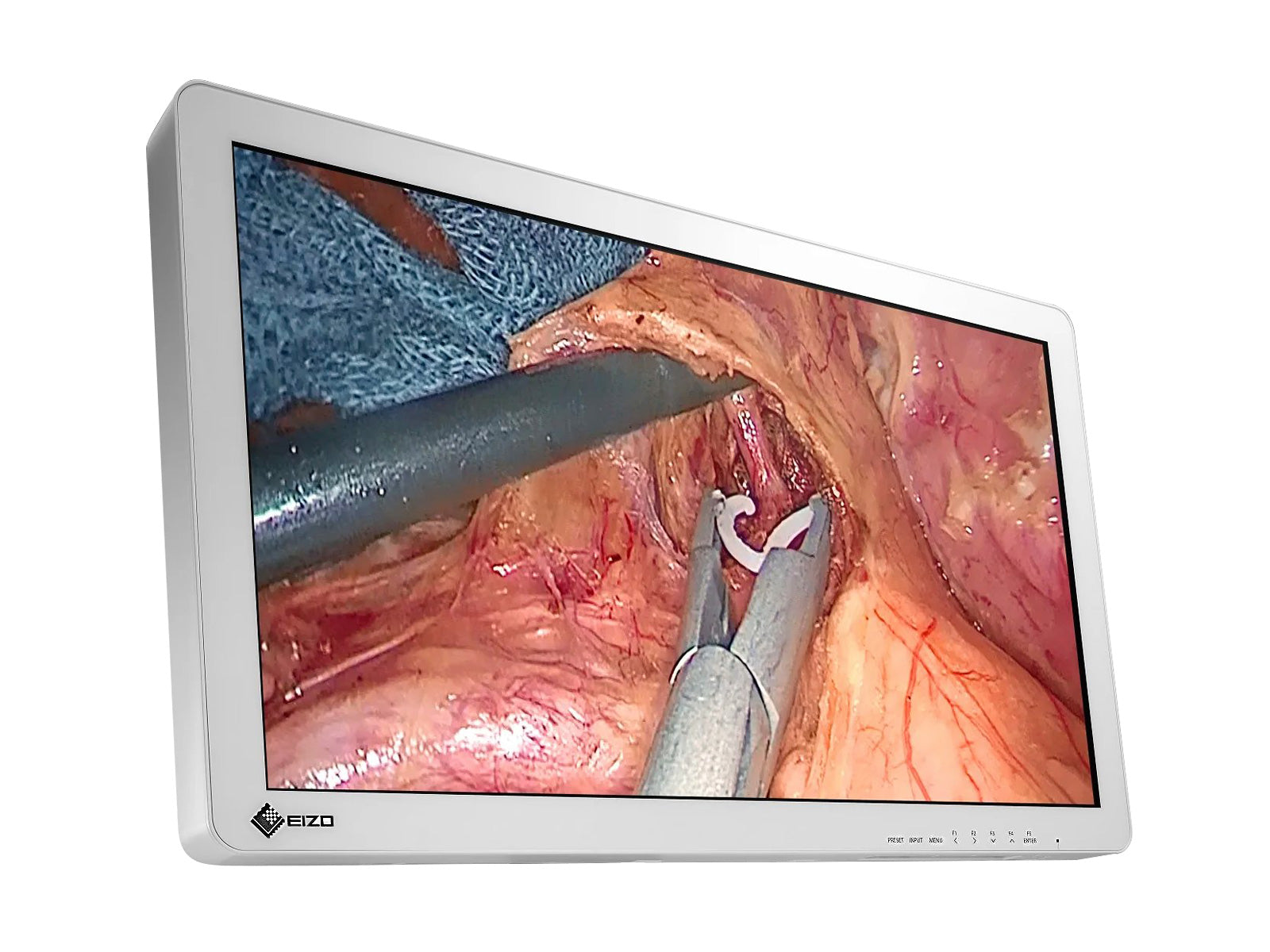Monitor Médico Eizo EX2721 27" – Uso Quirúrgico DICOM (2)