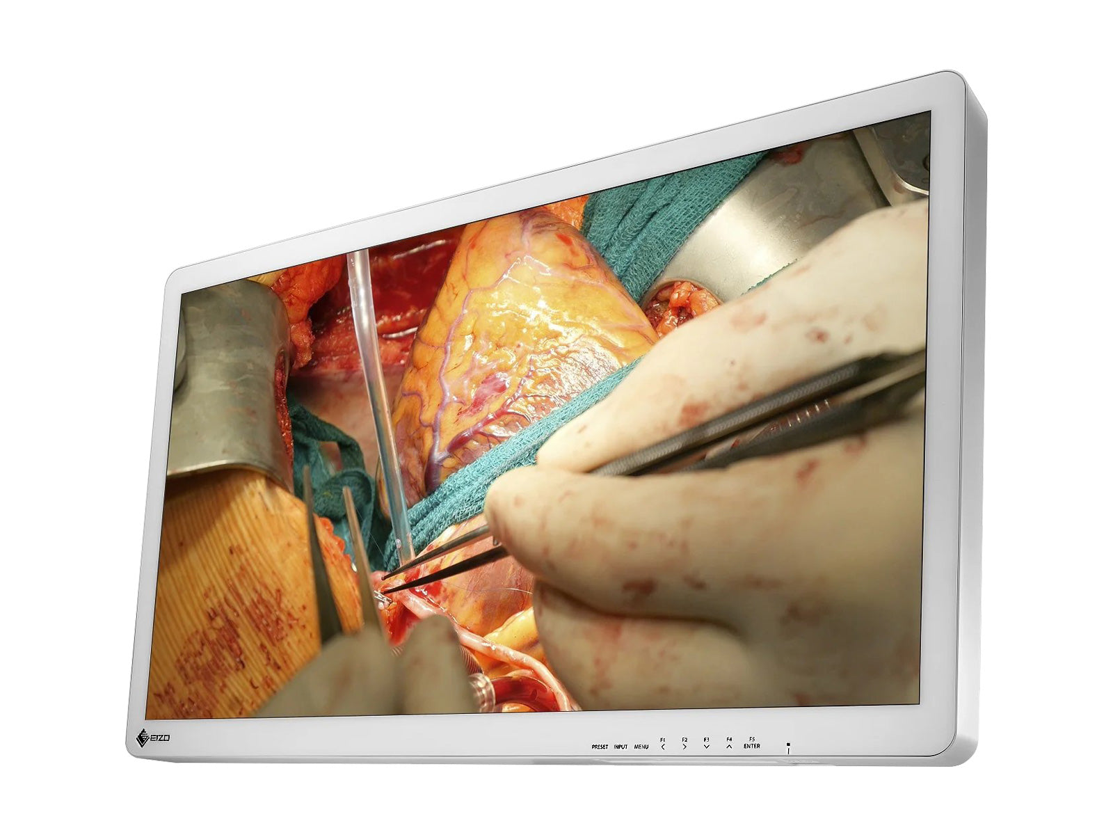 Monitor Médico Eizo EX3242 32" – Uso Quirúrgico DICOM (2)