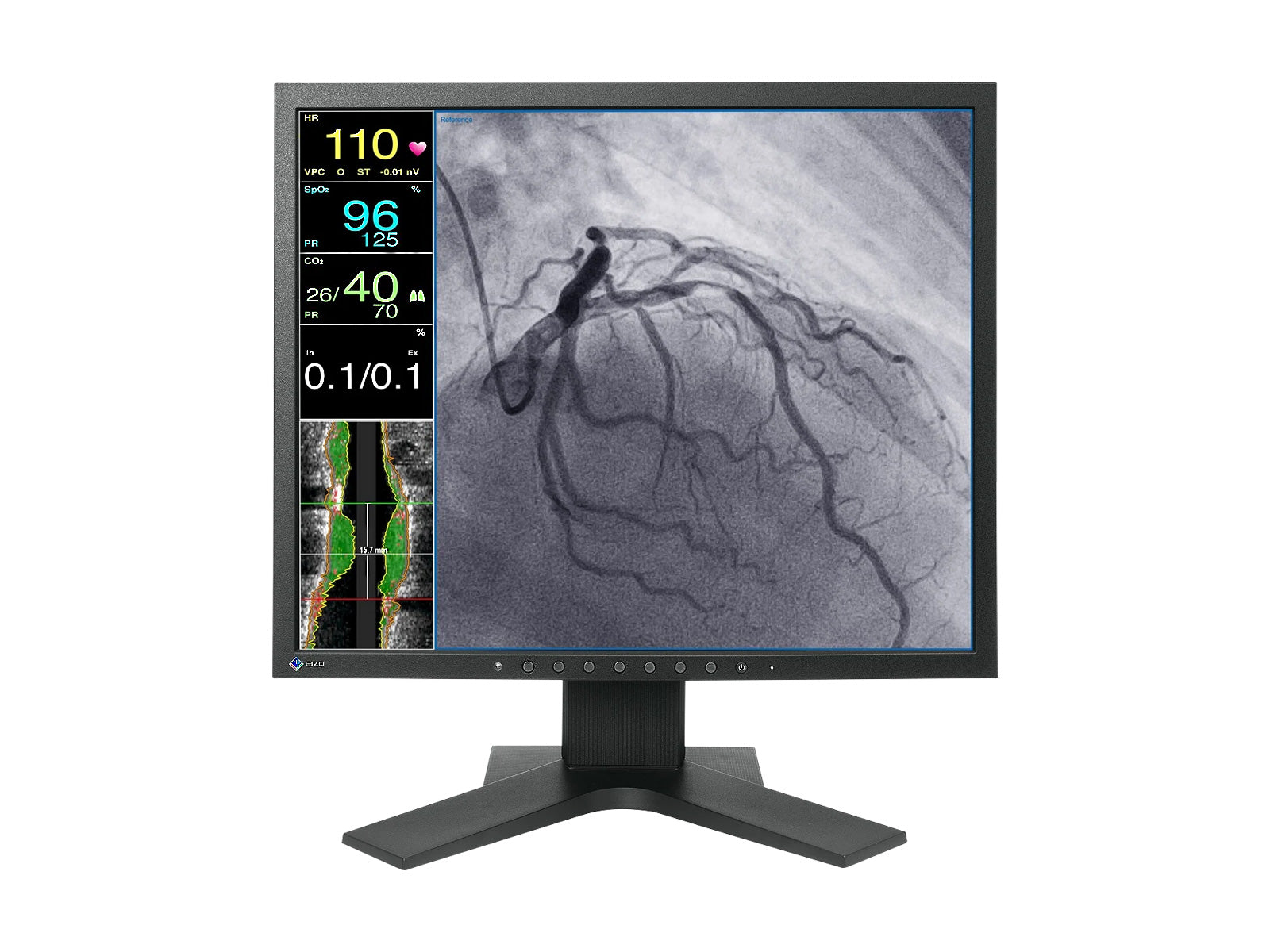 Monitor Médico Eizo LX1910-S 19" – Uso Quirúrgico DICOM (1)