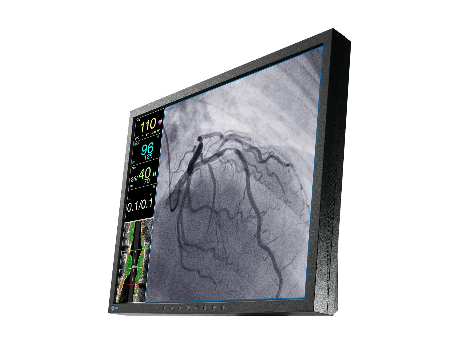 Monitor Médico Eizo LX1910-S 19" – Uso Quirúrgico DICOM (2)