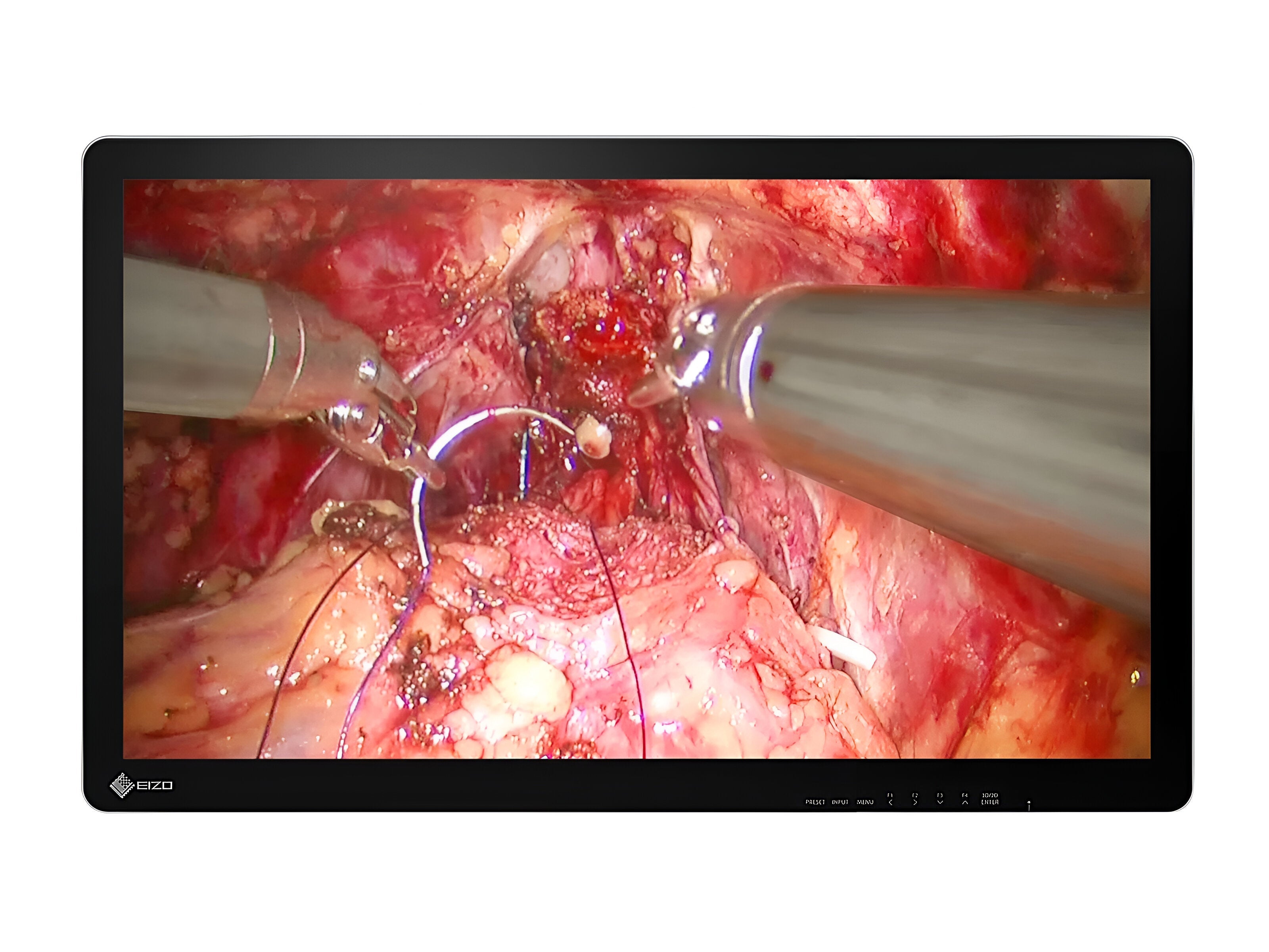 Monitor Médico Eizo EX3242-3D 32" – Uso Quirúrgico DICOM (1)