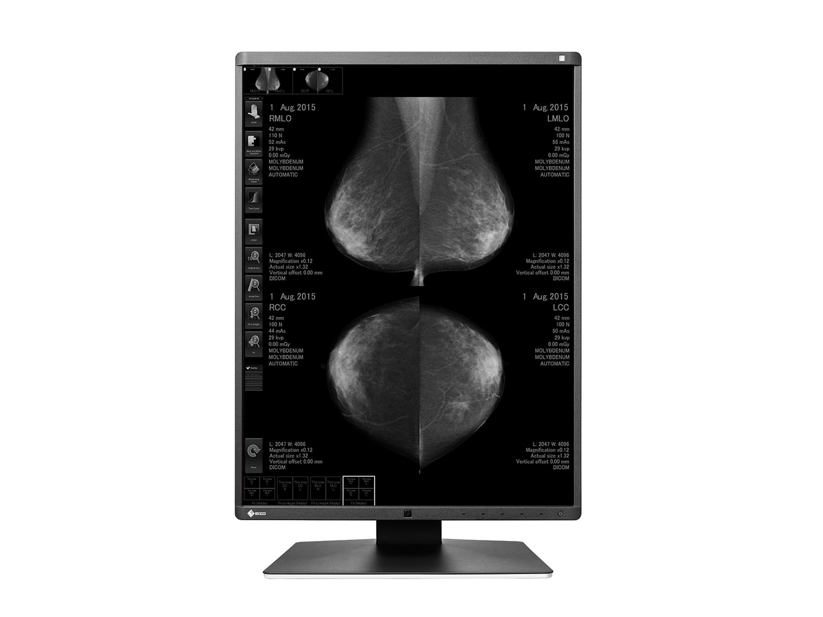 Monitor Médico Eizo GX560-MD 5MP – 21" – Escala de grises – Radiología Diagnóstica DICOM (4)
