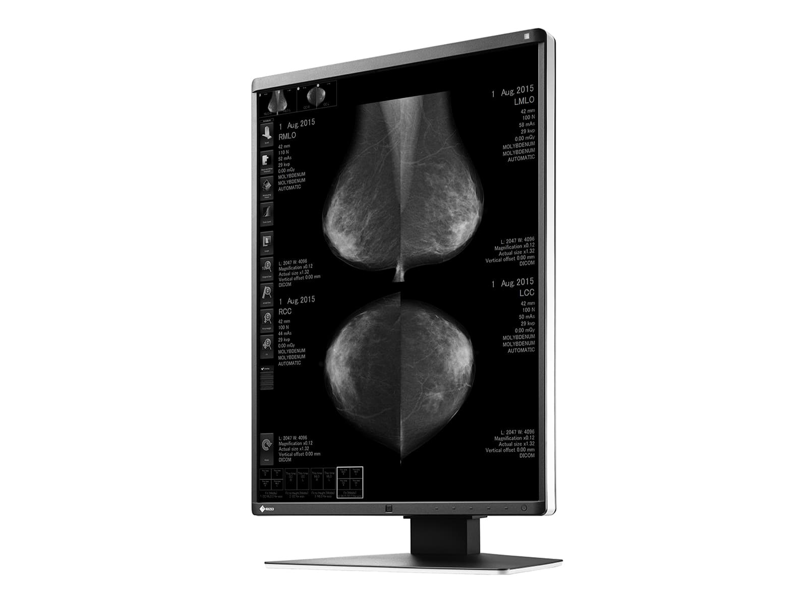 Monitor Médico Eizo GX560-MD 5MP – 21" – Escala de grises – Radiología Diagnóstica DICOM (5)