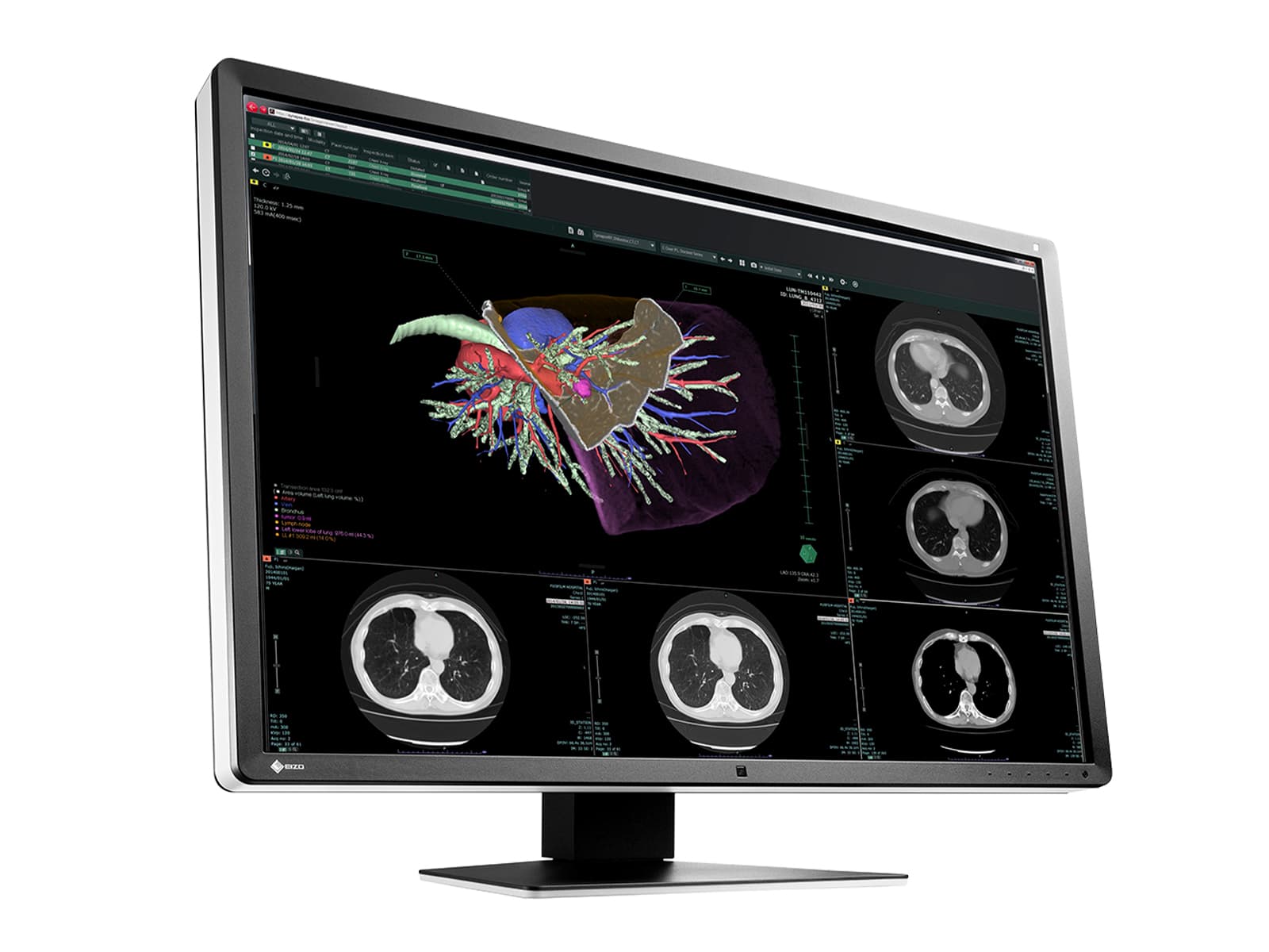 Monitor Médico Eizo RX660-AR 6MP – 30" – Color – Radiología Diagnóstica DICOM (2)