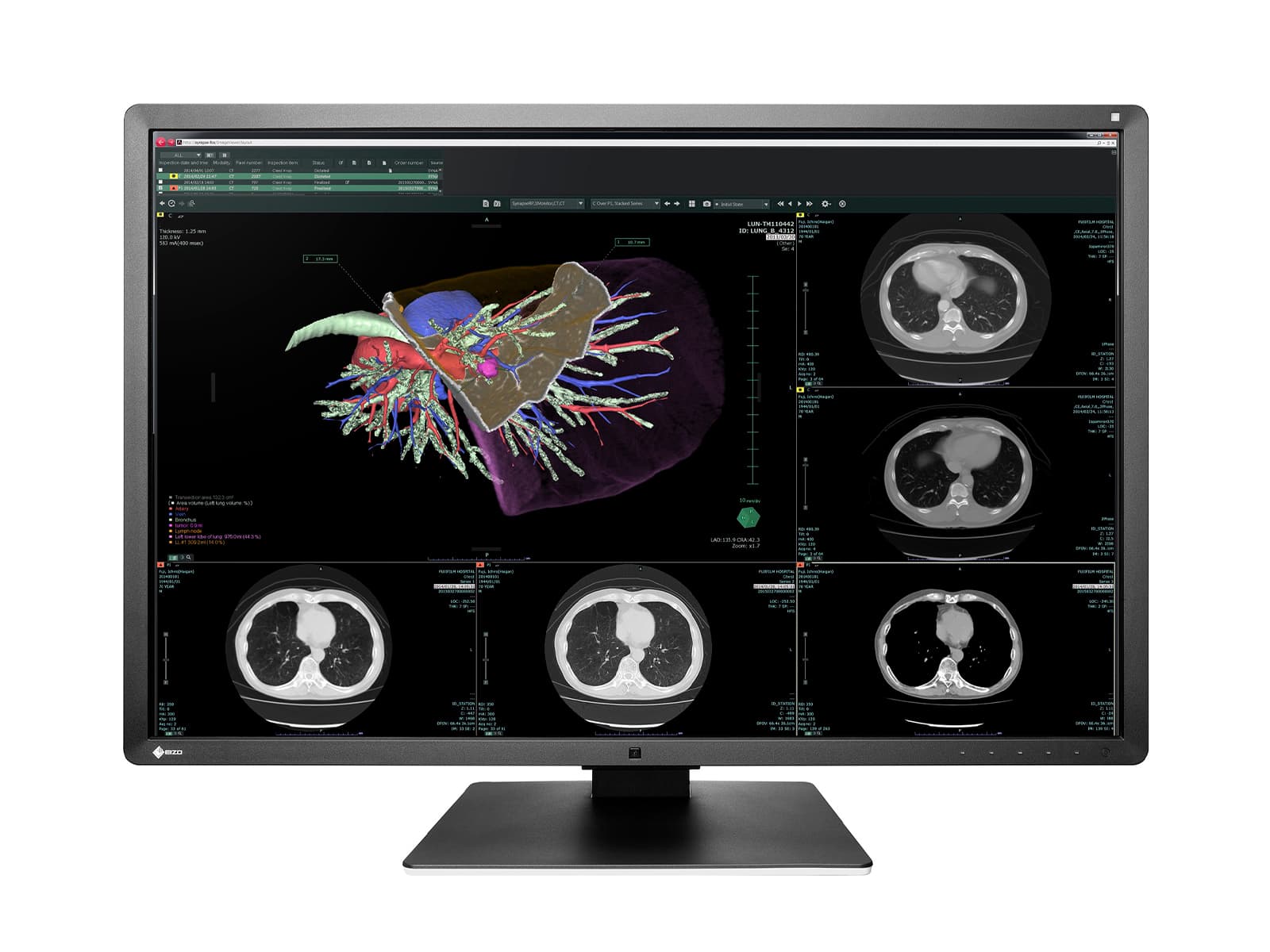 Monitor Médico Eizo RX660-AR 6MP – 30" – Color – Radiología Diagnóstica DICOM (1)