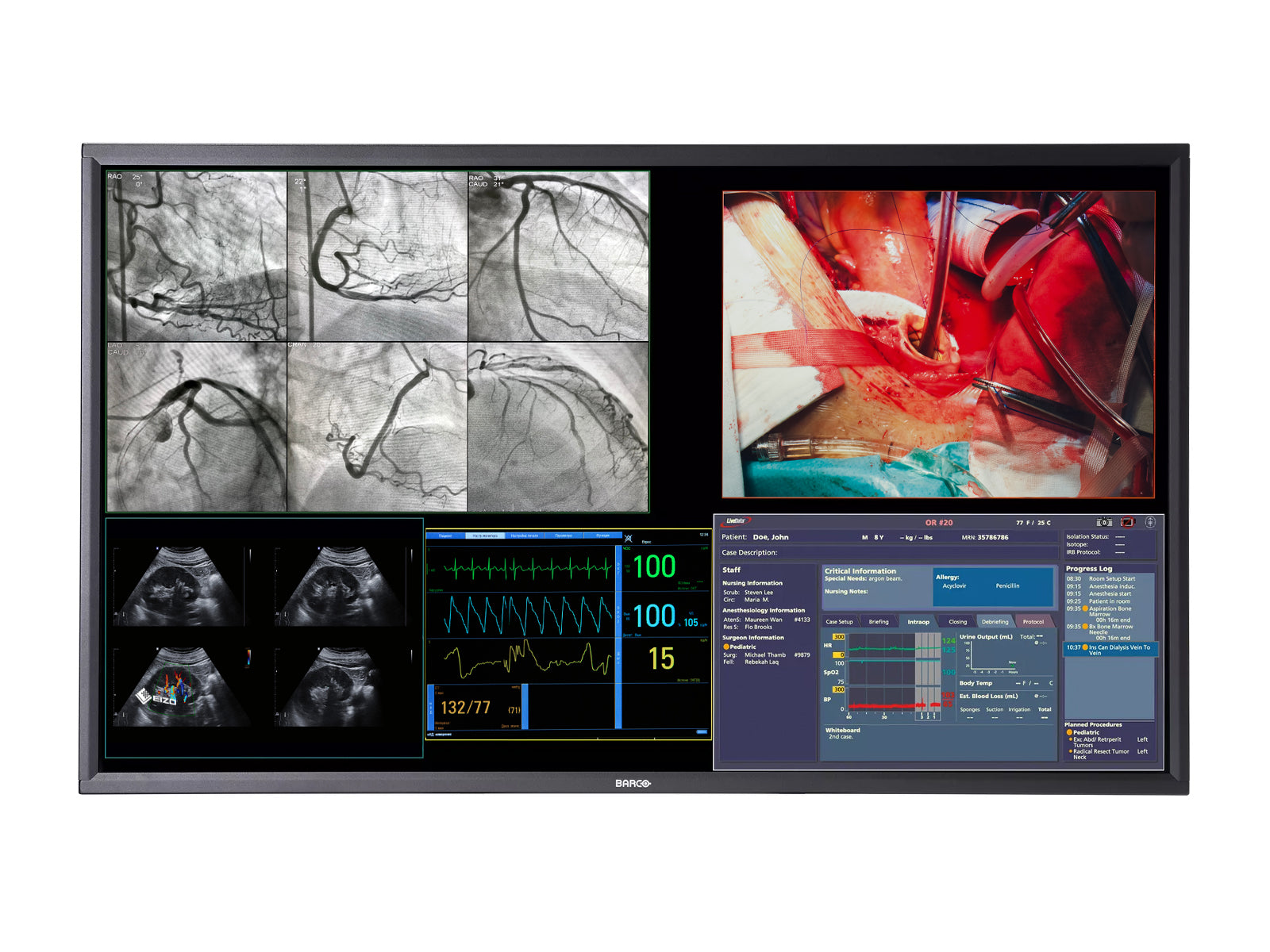 Monitor Médico Barco MDSC-8358 8MP – Uso Quirúrgico DICOM (1)