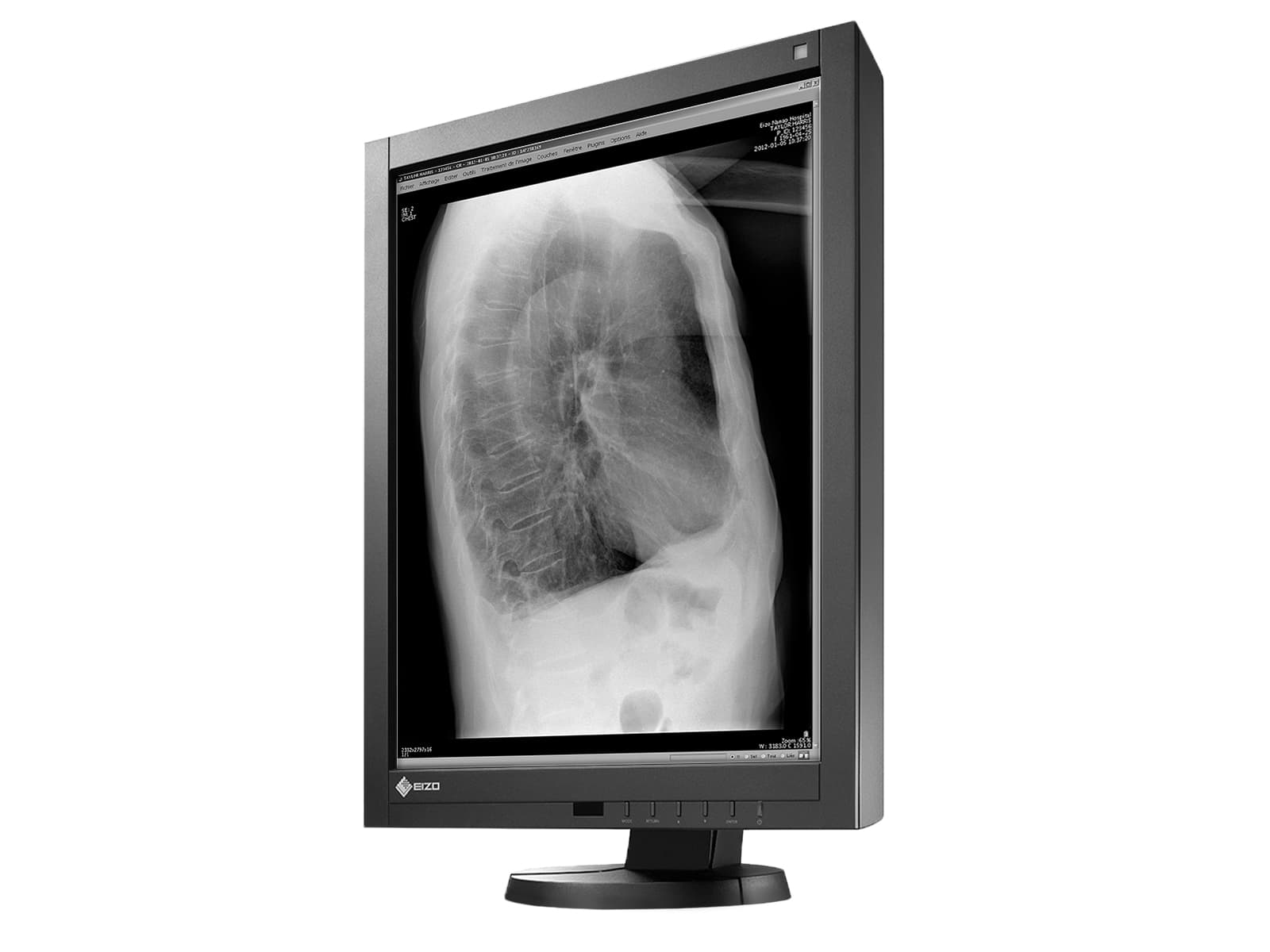 Monitor Médico Eizo GX240 2MP – 21" – Escala de grises – Radiología Diagnóstica DICOM (4)