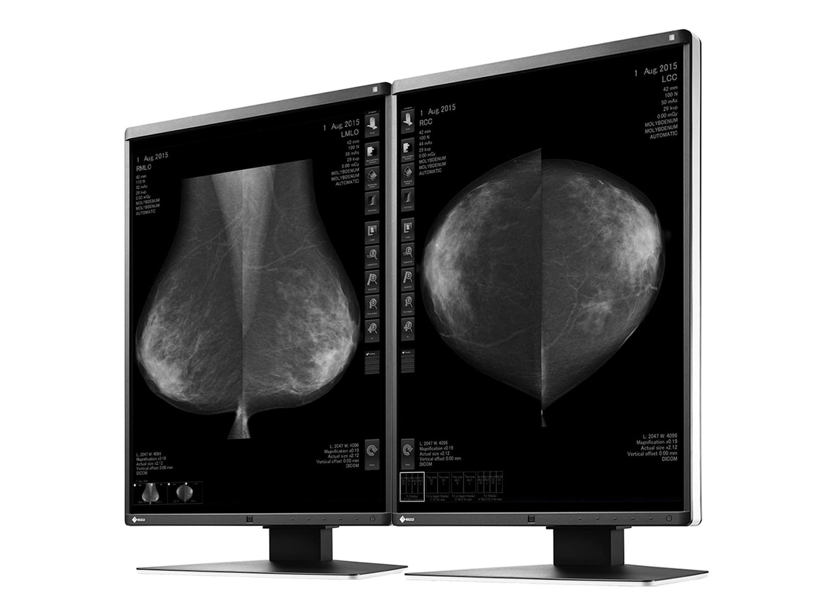 Monitor Médico Eizo GX560-MD 5MP – 21" – Escala de grises – Radiología Diagnóstica DICOM (2)