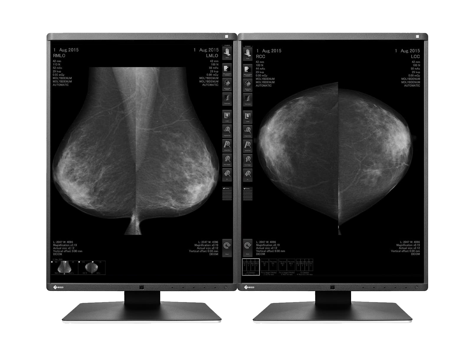 Monitor Médico Eizo GX560-MD 5MP – 21" – Escala de grises – Radiología Diagnóstica DICOM (1)