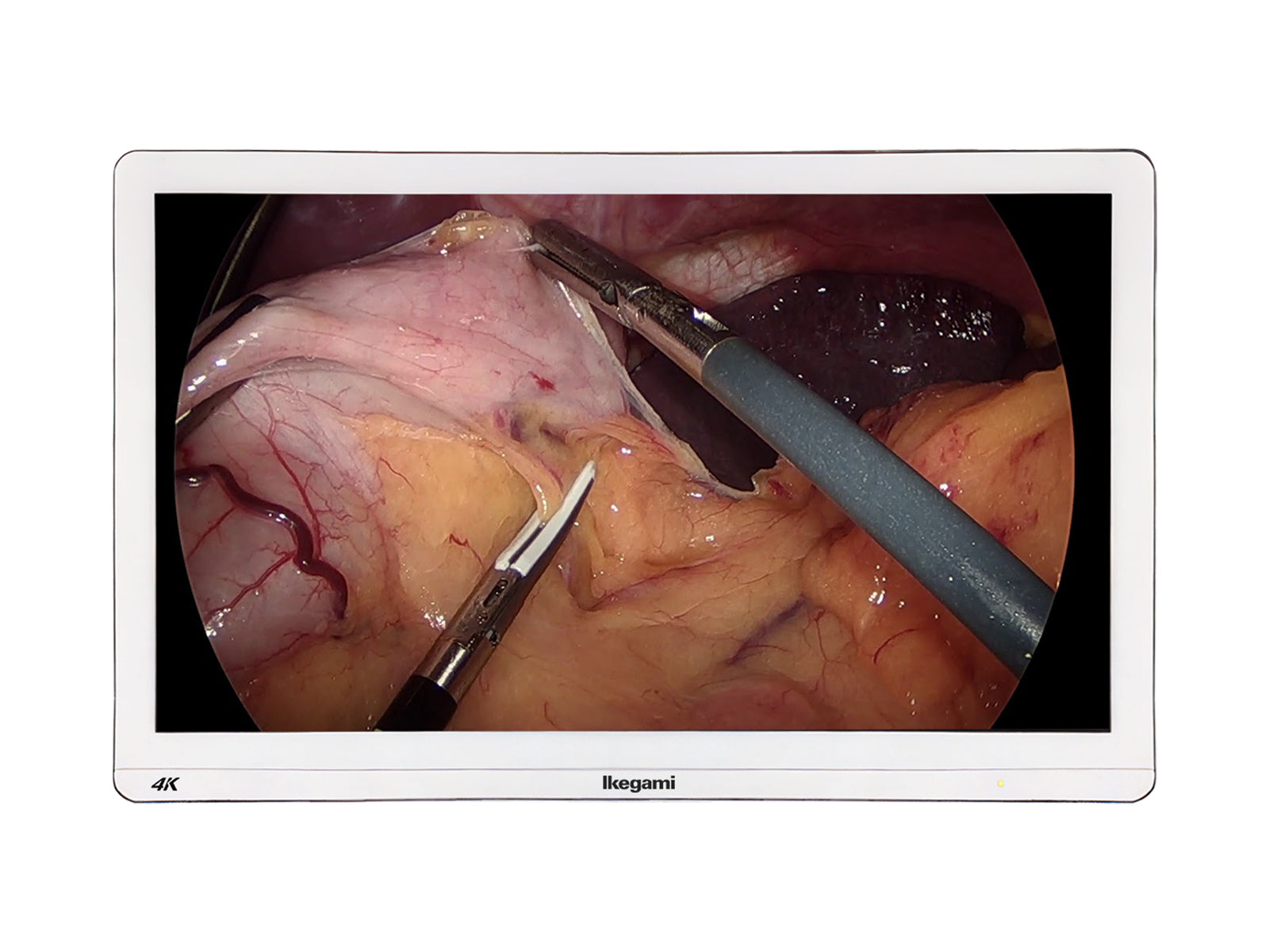 Monitor Médico Ikegami MLW-2750UHD 27" – Uso Quirúrgico (1)