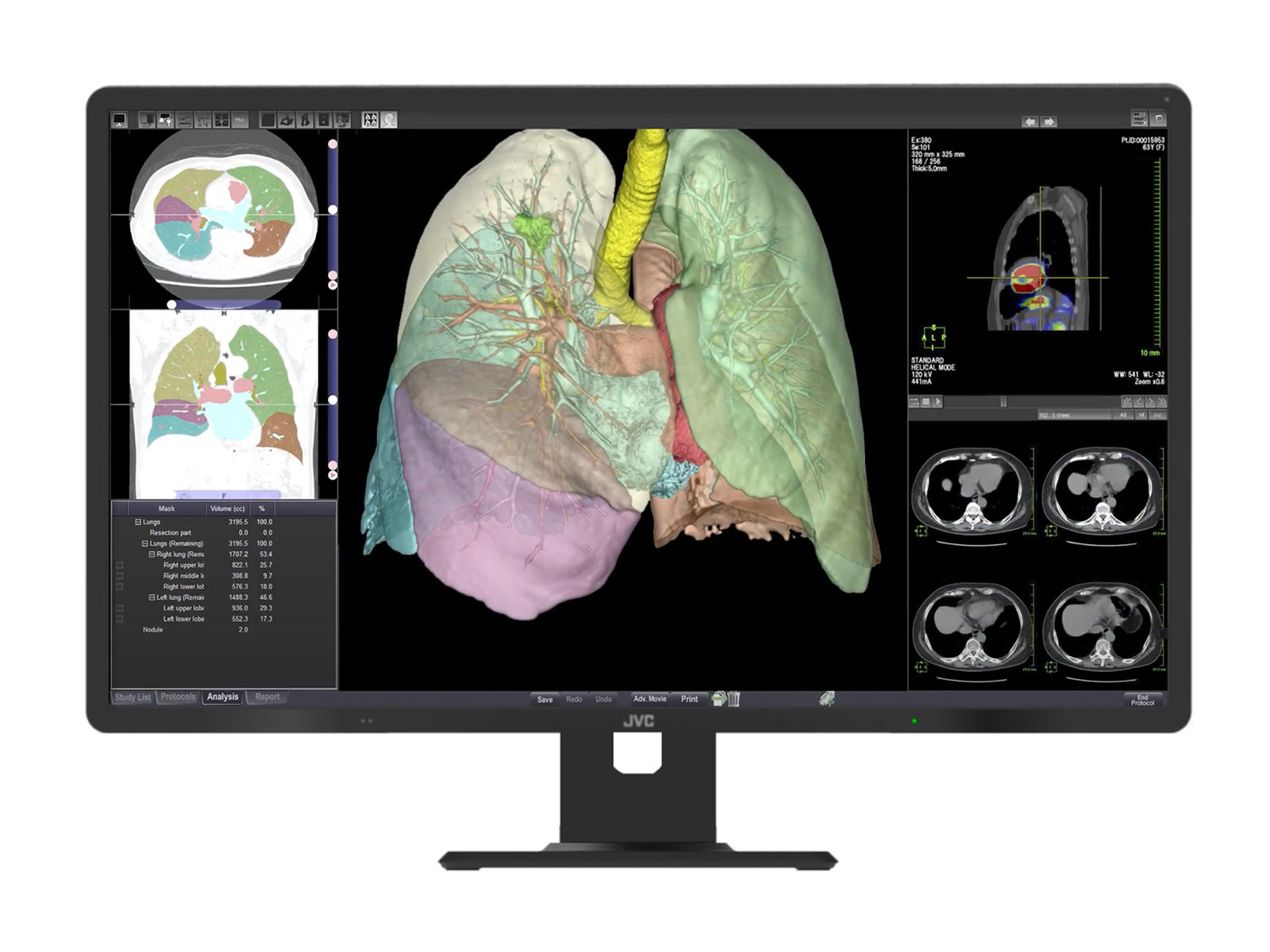Monitor Médico JVC CL-R813 8MP – 32" – Color – Radiología Diagnóstica (1)