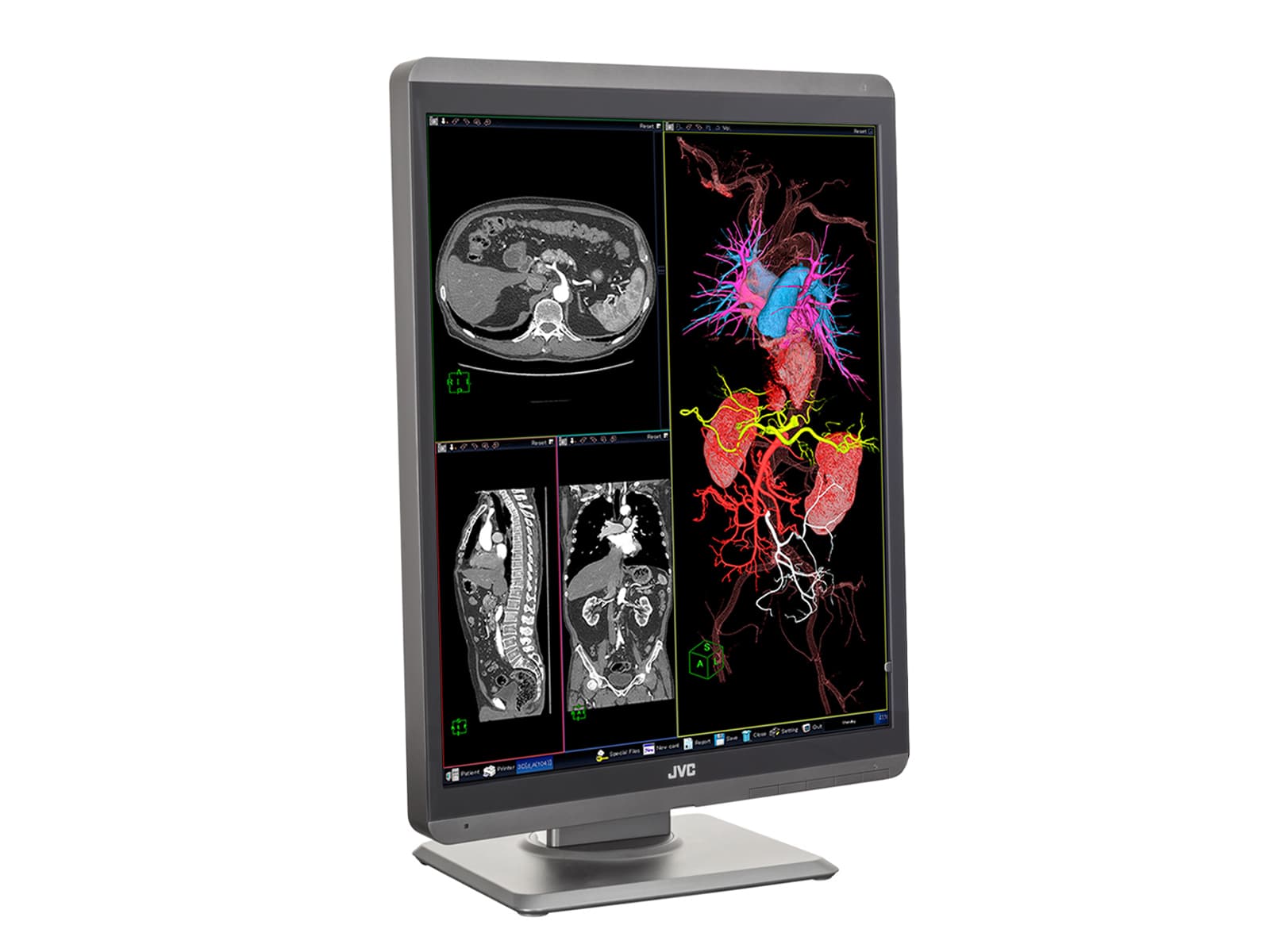 Monitor Médico JVC CL-S200 2MP – 21.3" – Color – Radiología Diagnóstica DICOM (5)