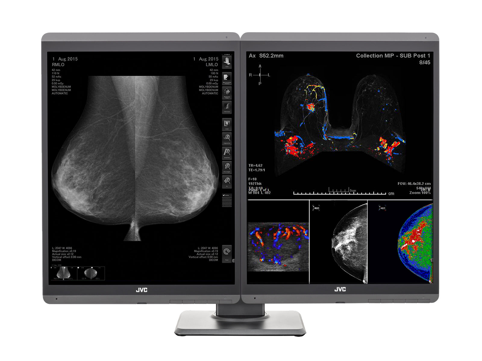 Monitor Médico JVC CL-S500 5MP – 21.3" – Color – Radiología Diagnóstica DICOM (2)