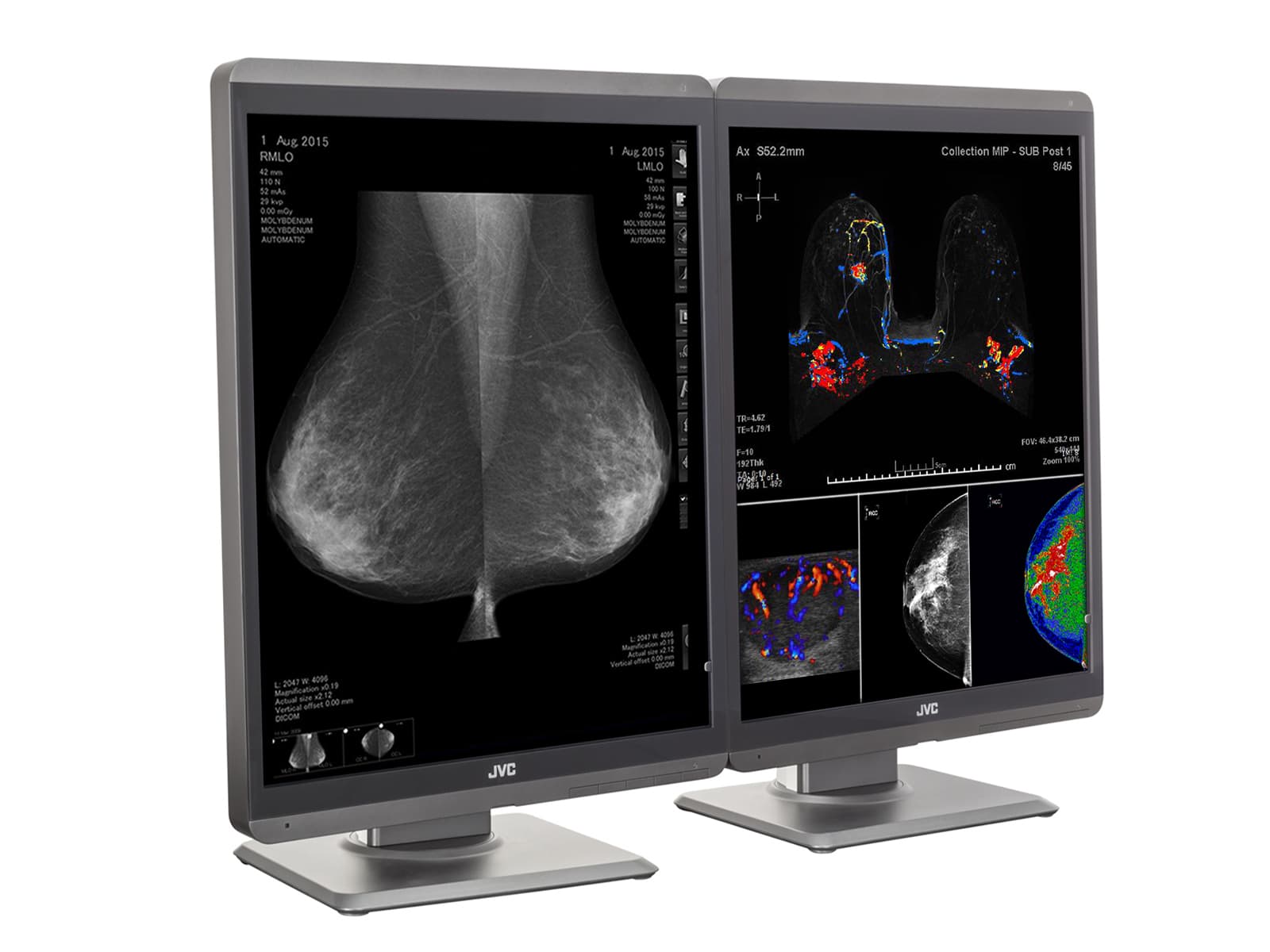 Monitor Médico JVC CL-S500 5MP – 21.3" – Color – Radiología Diagnóstica DICOM (3)