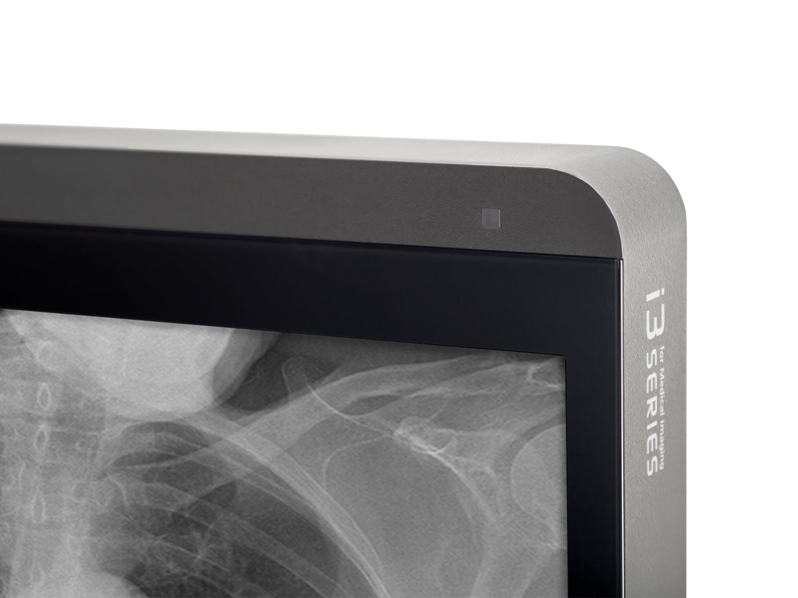 Monitor Médico JVC MS-S200 2MP – 21.3" – Escala de grises – Radiología Diagnóstica DICOM (7)