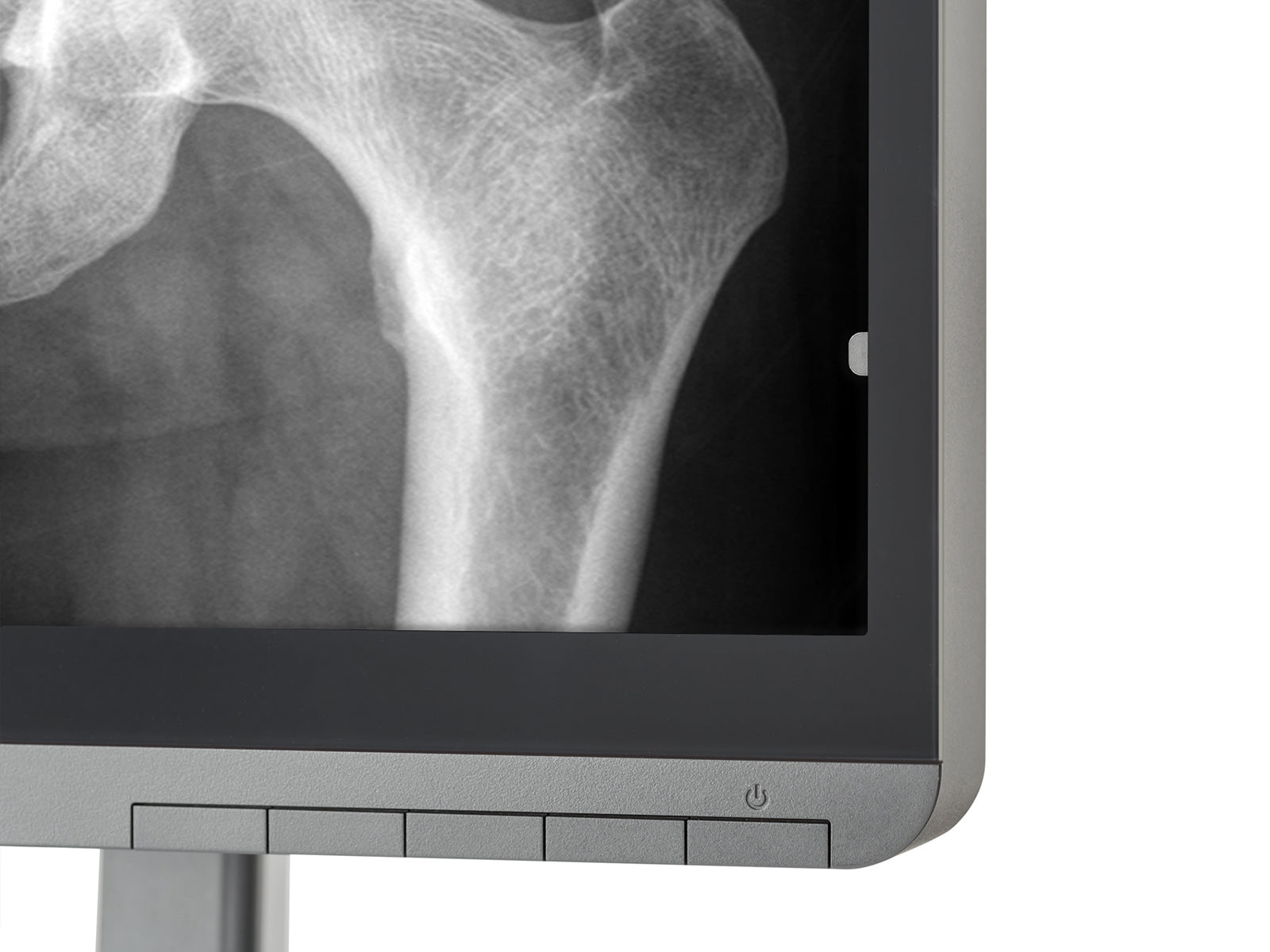 Monitor Médico JVC MS-S200 2MP – 21.3" – Escala de grises – Radiología Diagnóstica DICOM (8)