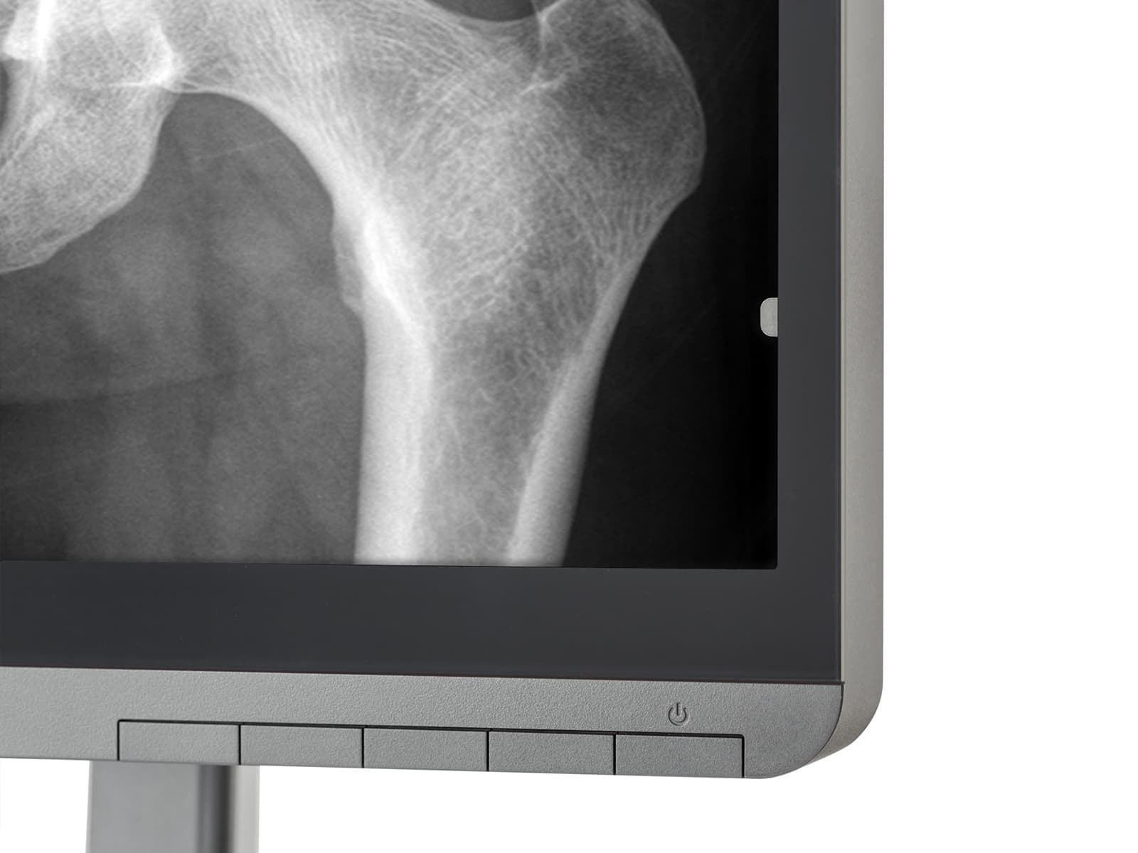Monitor Médico JVC CL-S200 2MP – 21.3" – Color – Radiología Diagnóstica DICOM (8)
