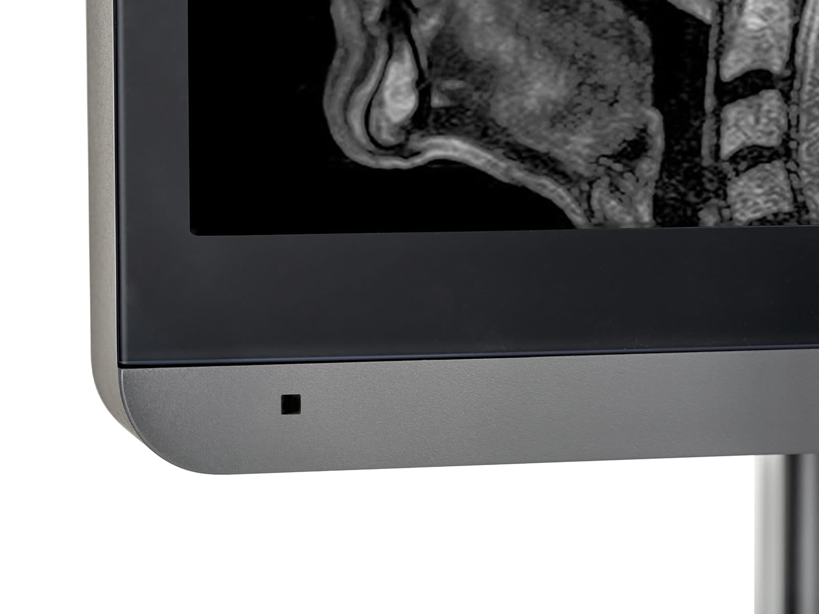 Monitor Médico JVC MS-S500 5MP – 21.3" – Escala de grises – Radiología Diagnóstica (7)
