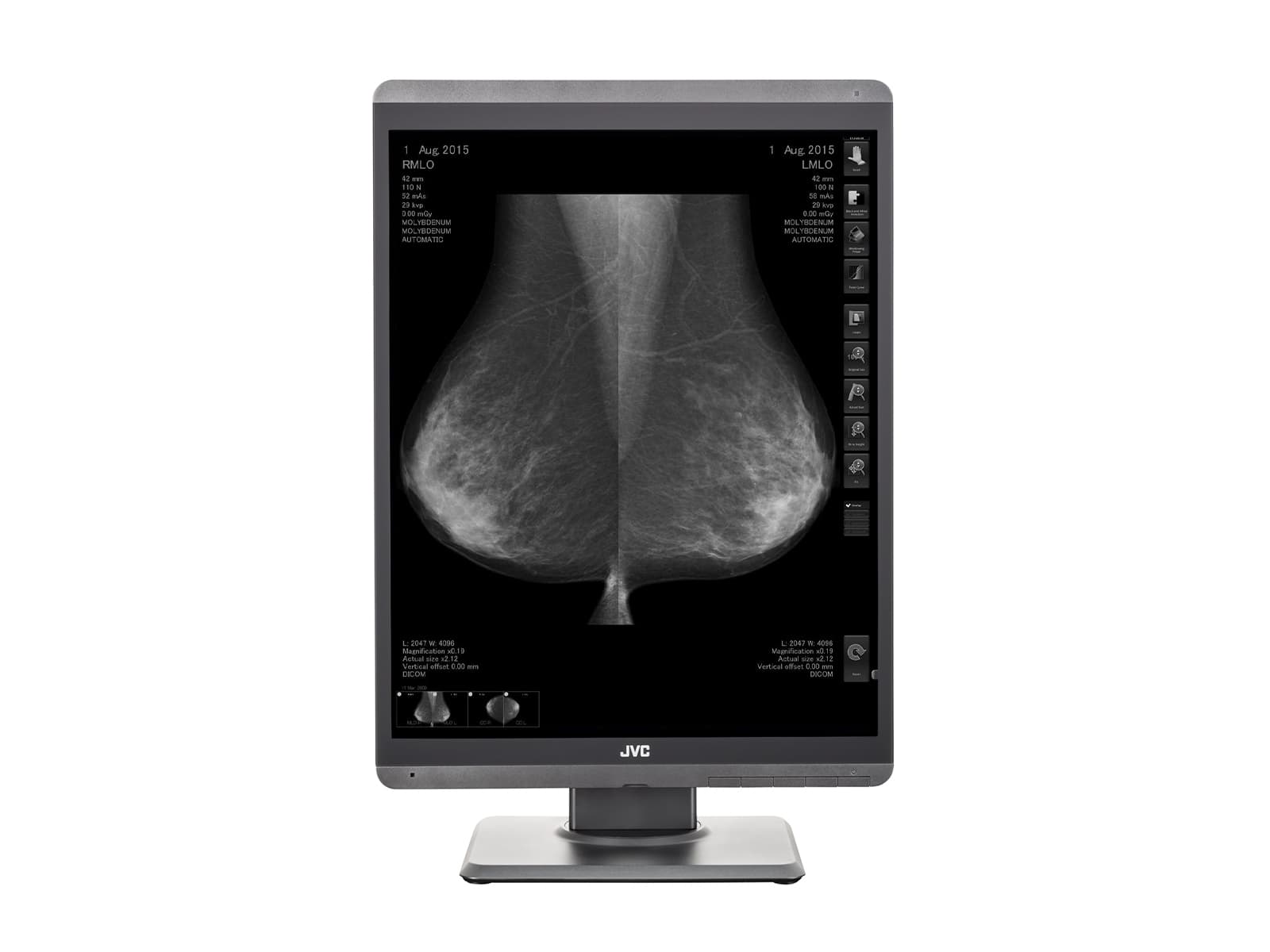 Monitor Médico JVC MS-S500 5MP – 21.3" – Escala de grises – Radiología Diagnóstica (4)