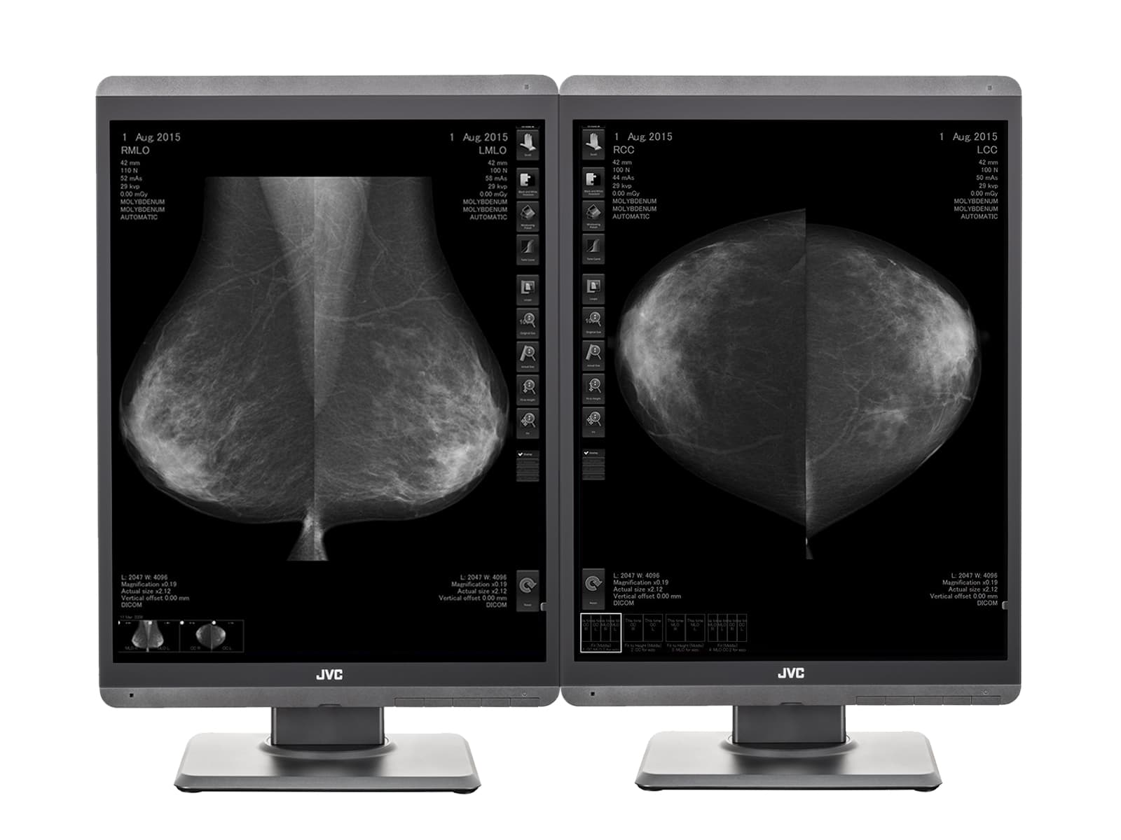 Monitor Médico JVC MS-S500 5MP – 21.3" – Escala de grises – Radiología Diagnóstica (1)
