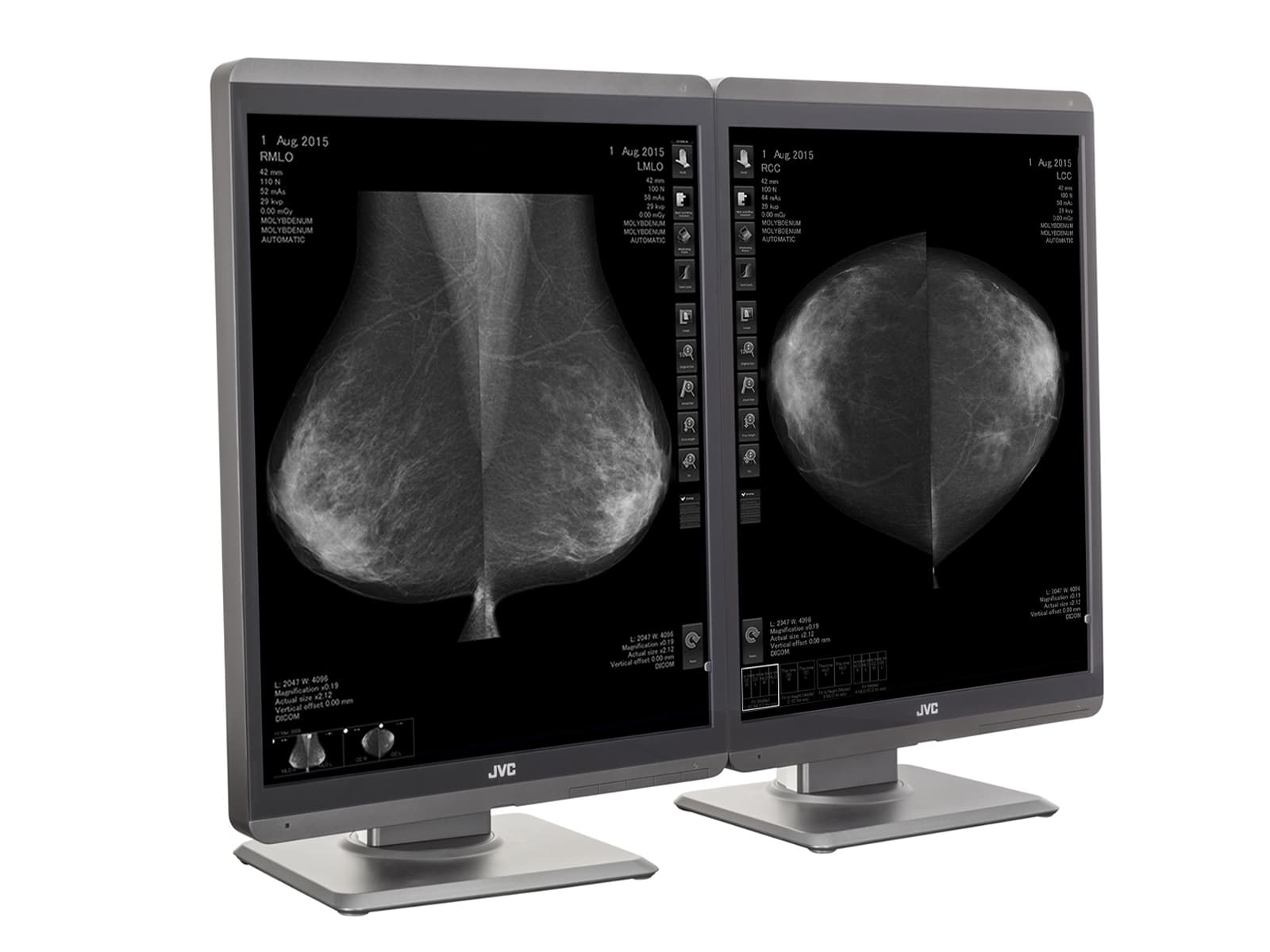 Monitor Médico JVC MS-S500 5MP – 21.3" – Escala de grises – Radiología Diagnóstica (2)