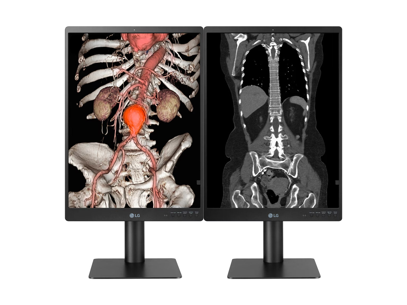 Monitor Médico LG 21HQ513D 3MP – 21" – Color – Radiología Diagnóstica (1)