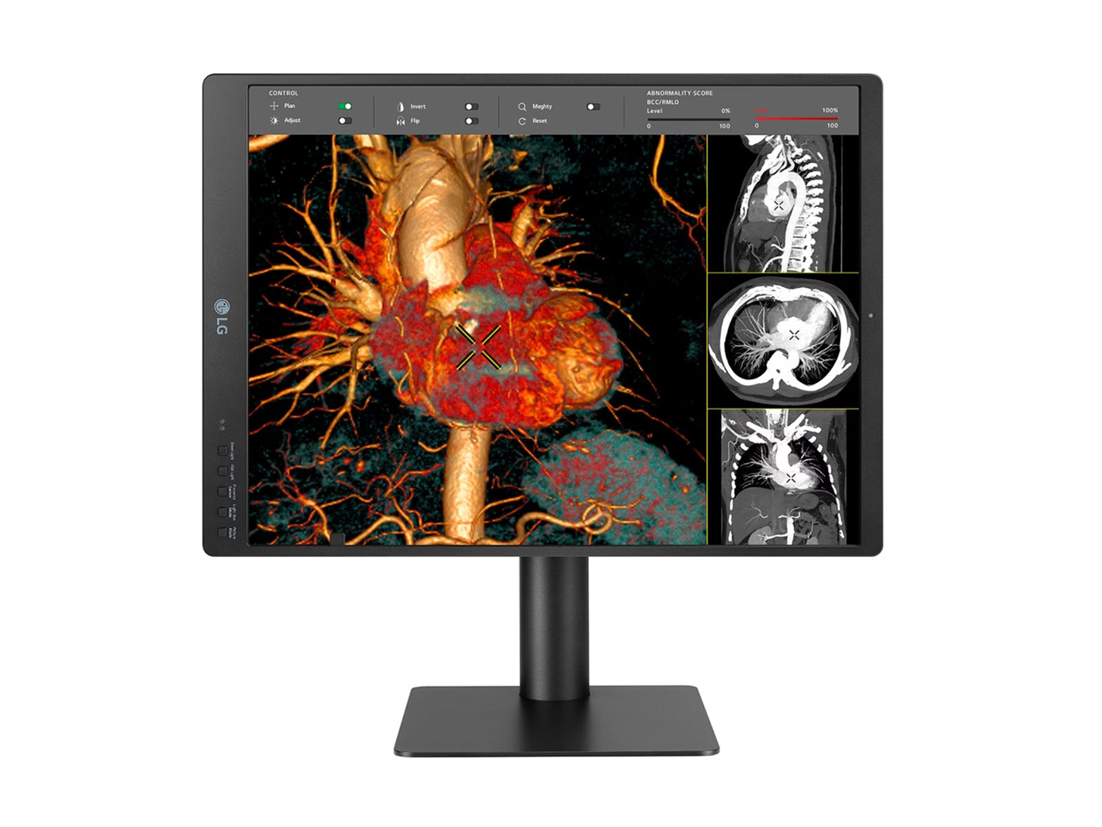 Monitor Médico LG 21HQ513D 3MP – 21" – Color – Radiología Diagnóstica (3)