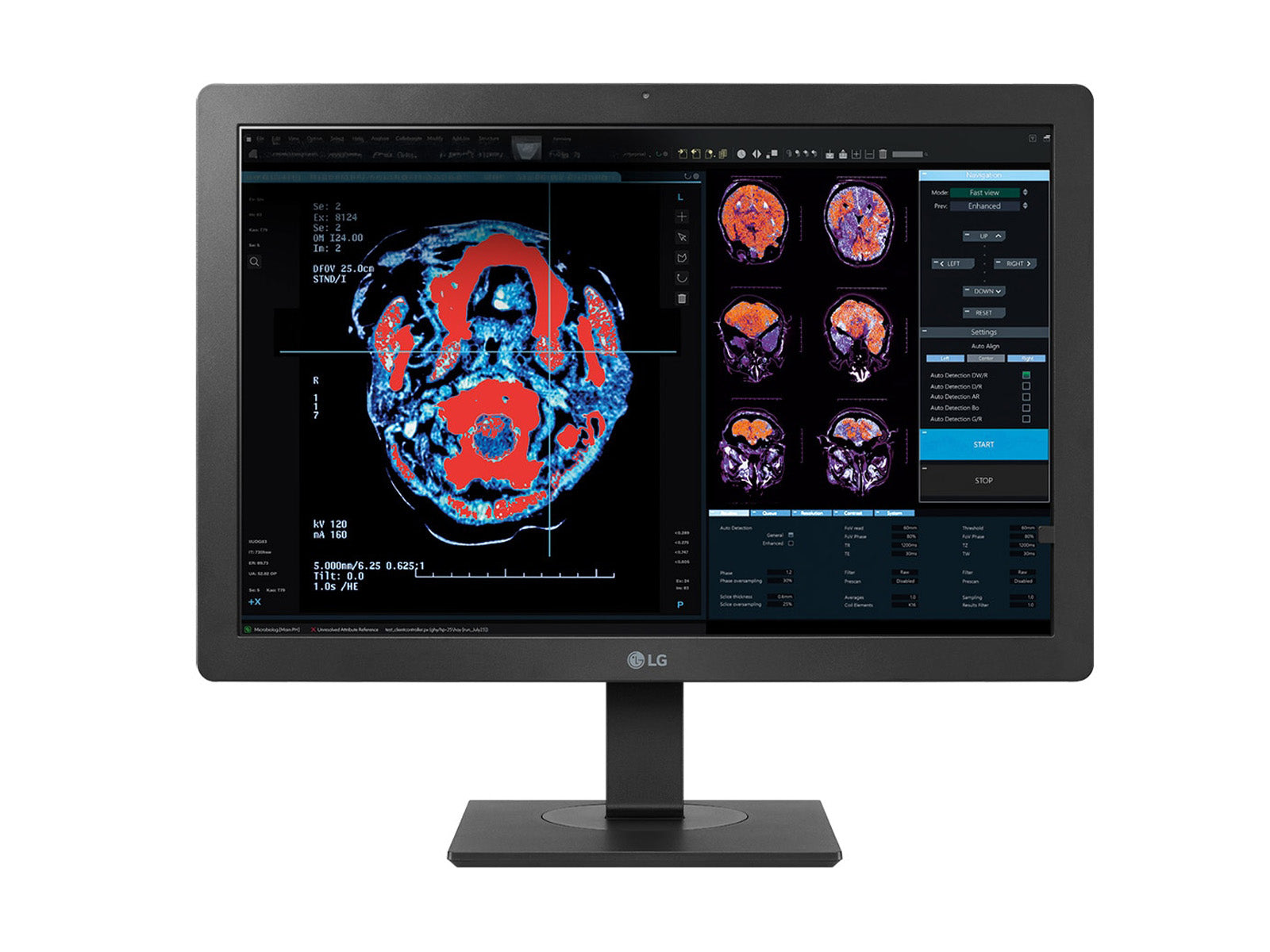Monitor Médico LG 24HR513C-B 2MP – 24" – Radiología Diagnóstica DICOM (1)
