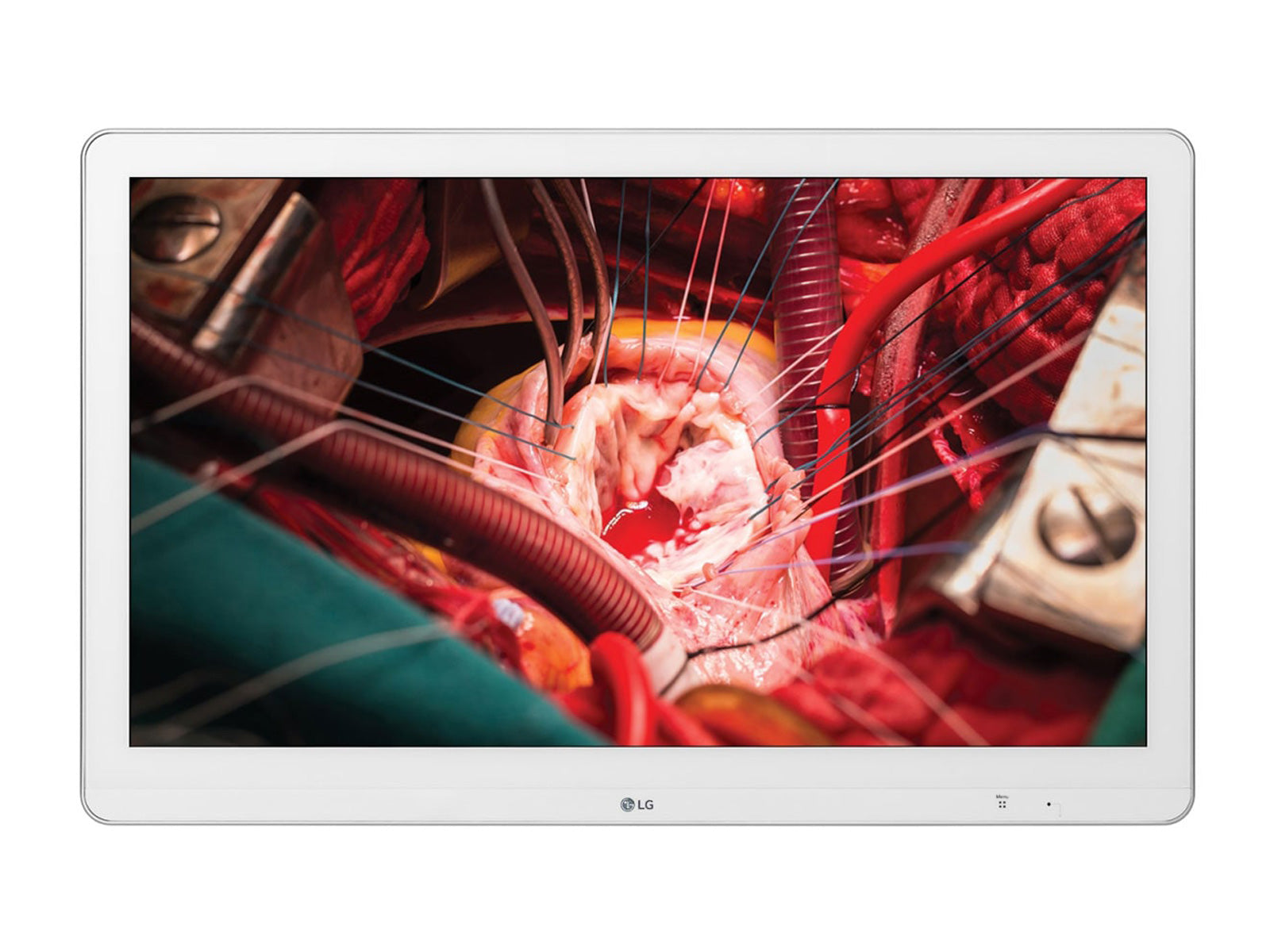 Monitor Médico LG 27HK510S-W 2MP – Uso Quirúrgico DICOM (1)