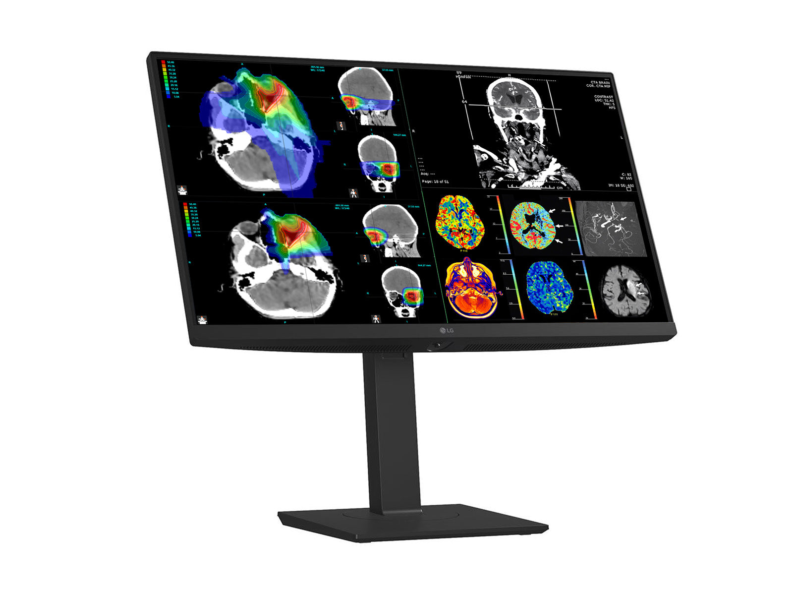 Monitor Médico LG 27HS713C 8MP – 27" – Color – Radiología Diagnóstica DICOM (3)