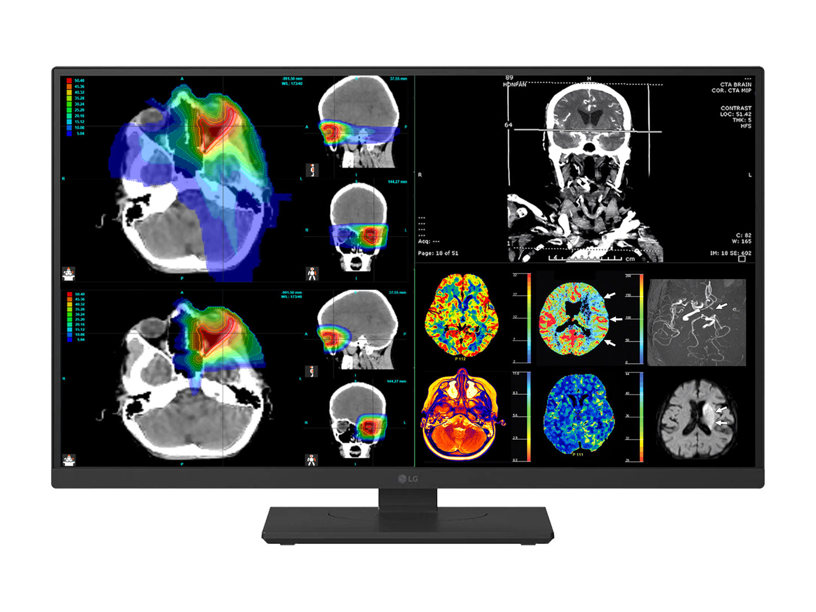 Monitor Médico LG 27HS713C 8MP – 27" – Color – Radiología Diagnóstica DICOM (4)