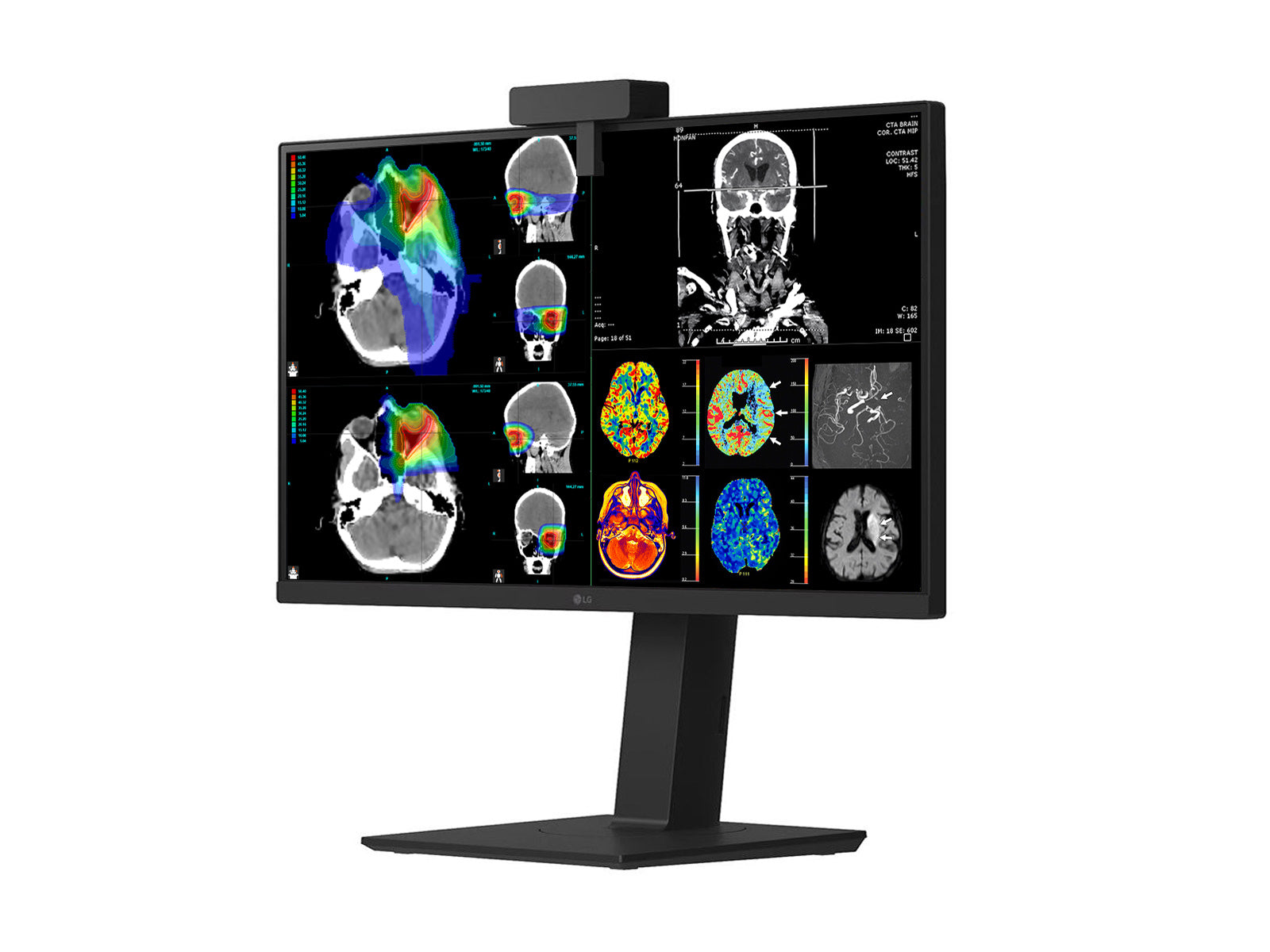 Monitor Médico LG 27HS713C 8MP – 27" – Color – Radiología Diagnóstica DICOM (5)