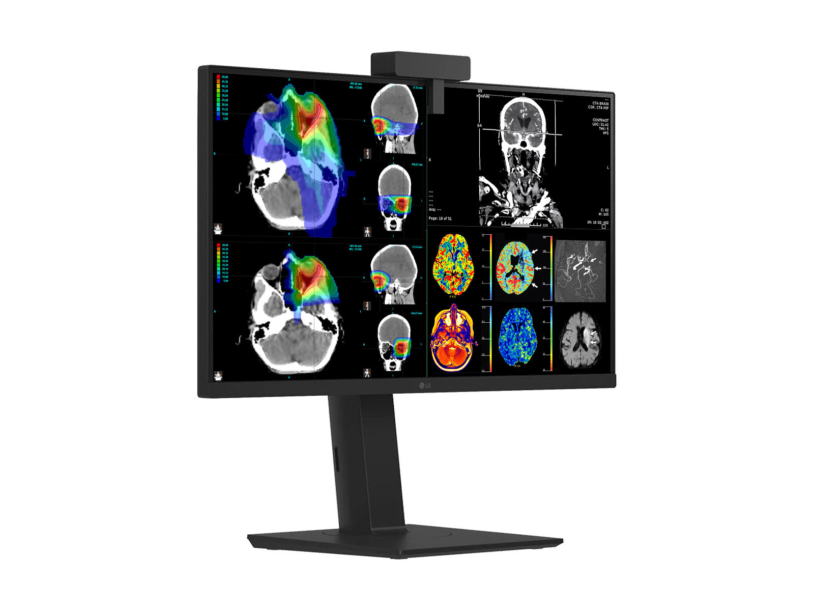 Monitor Médico LG 27HS713C 8MP – 27" – Color – Radiología Diagnóstica DICOM (6)