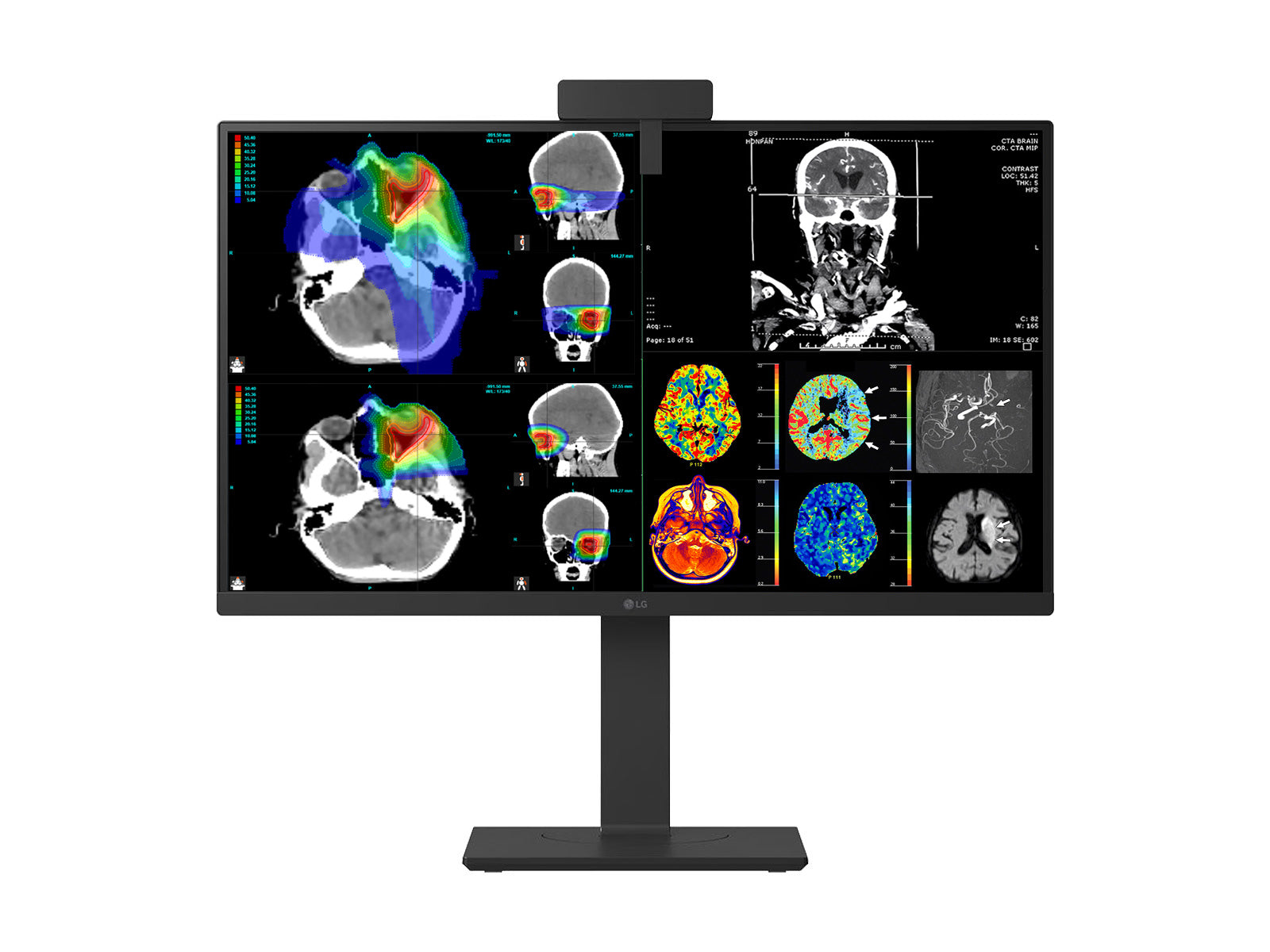 Monitor Médico LG 27HS713C 8MP – 27" – Color – Radiología Diagnóstica DICOM (7)