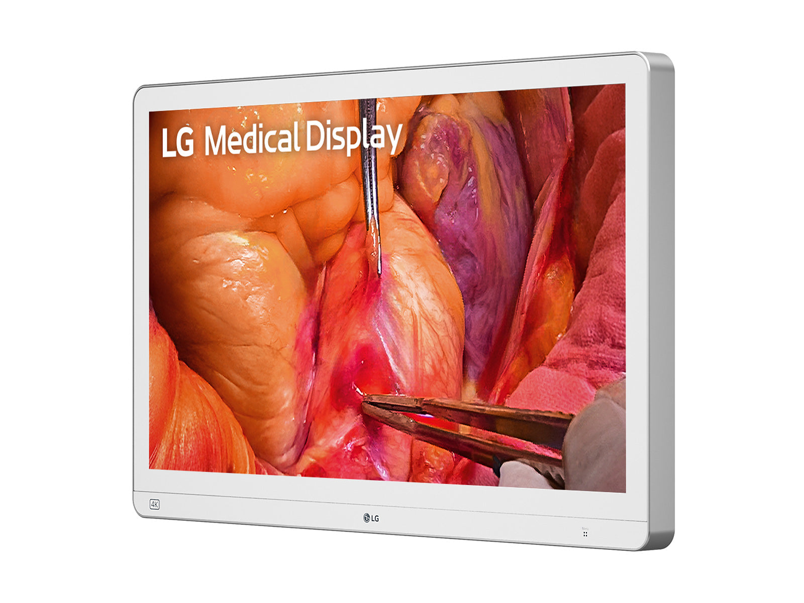 Monitor Médico LG 27HS714S-W 27" – Uso Quirúrgico (2)