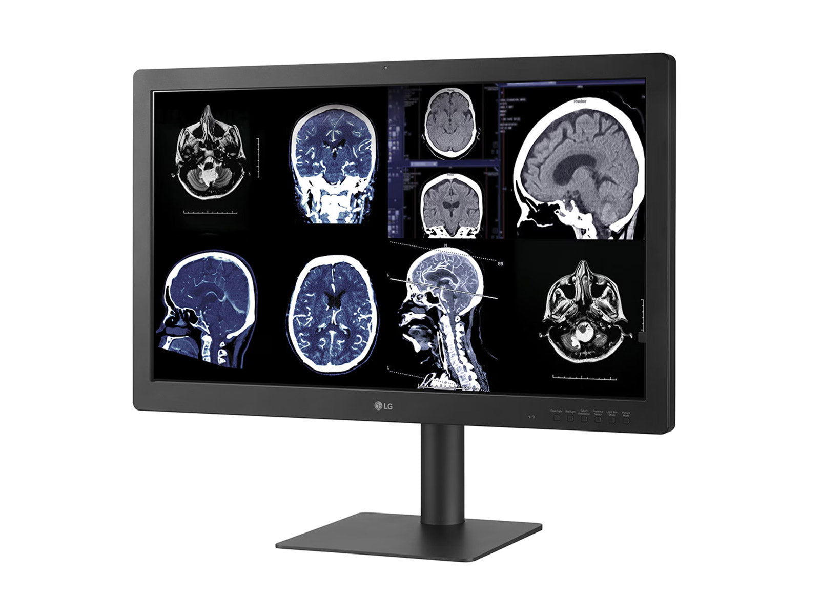 Monitor Médico LG 32HQ713D-B 8MP – 32" – Color – Radiología Diagnóstica DICOM (2)