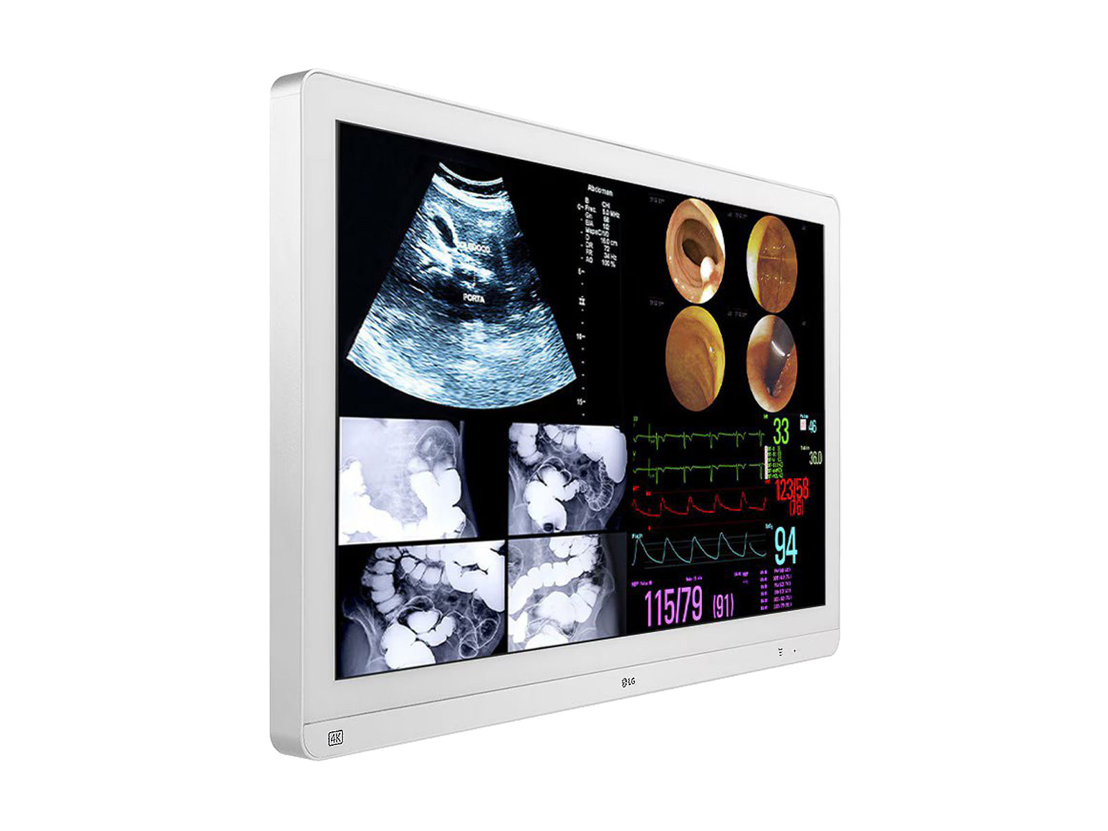 Monitor Médico LG 32HL714S-W 31.5" – Uso Quirúrgico DICOM (2)