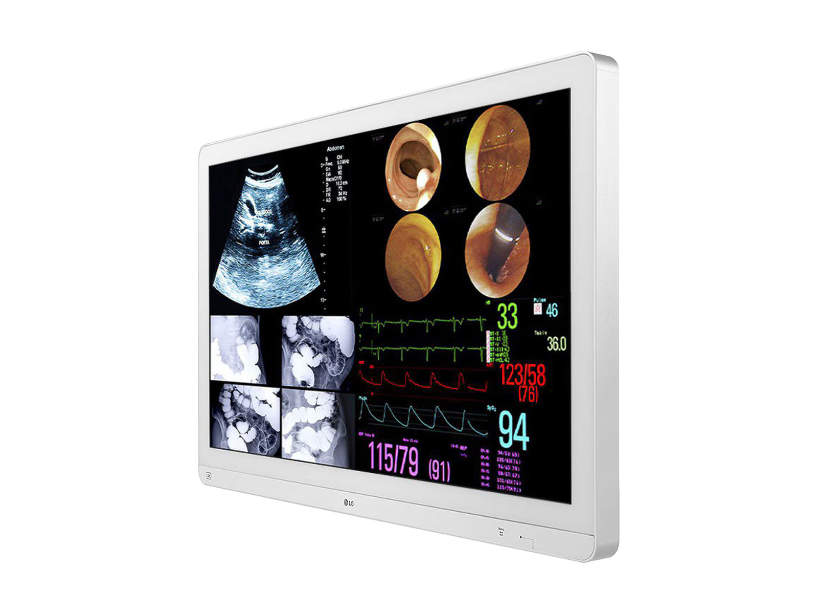 Monitor Médico LG 32HL714S-W 31.5" – Uso Quirúrgico DICOM (3)