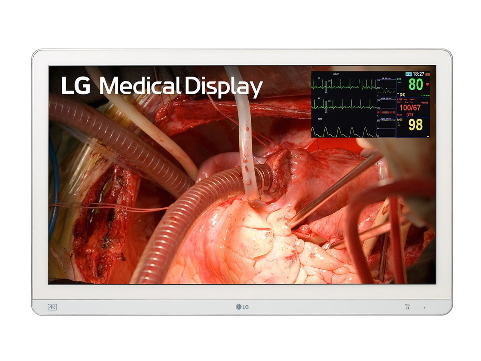 Monitor Médico LG 27HQ710S-W 27" – Uso Quirúrgico (1)
