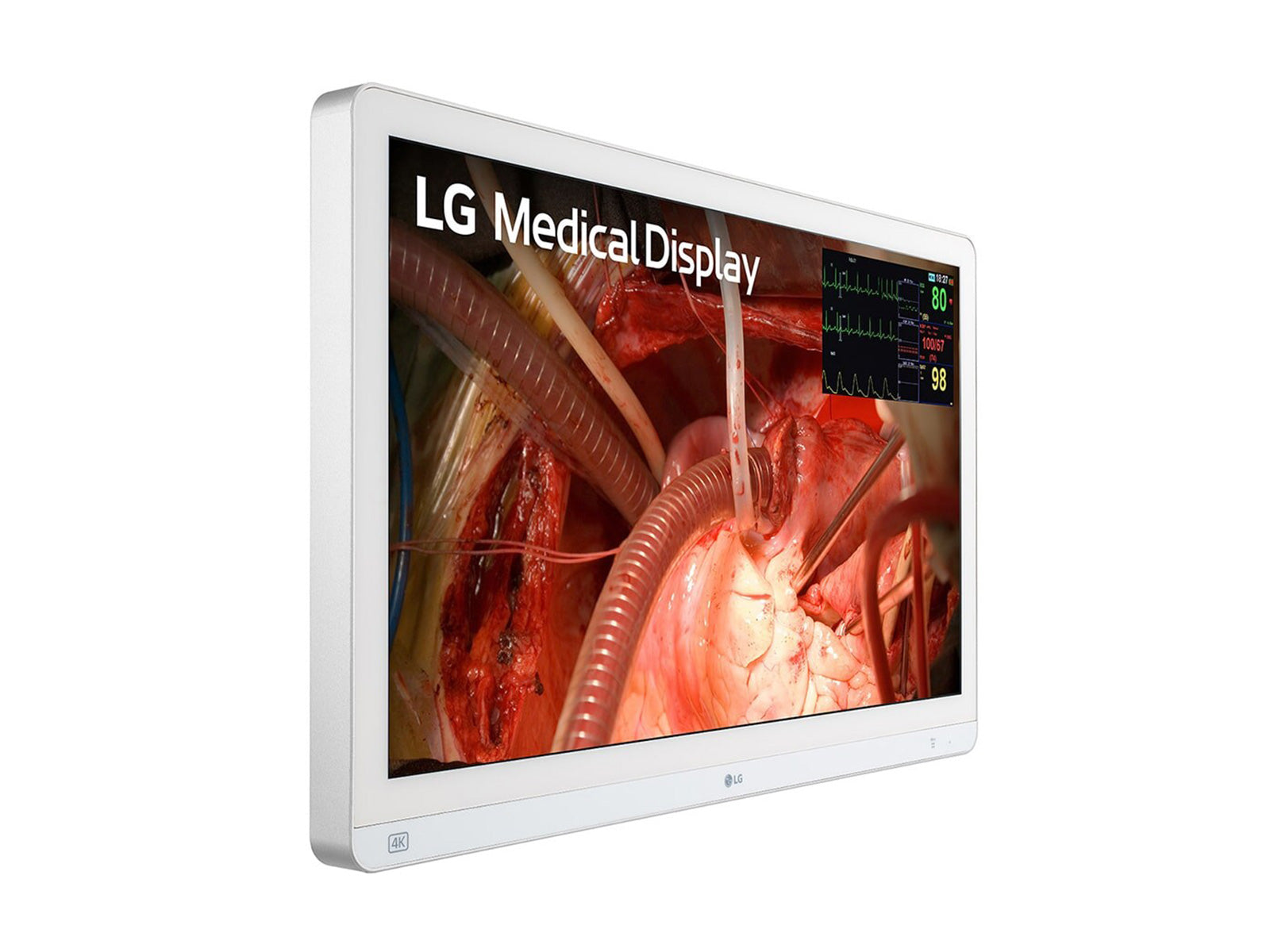 Monitor Médico LG 27HQ710S-W 27" – Uso Quirúrgico (3)