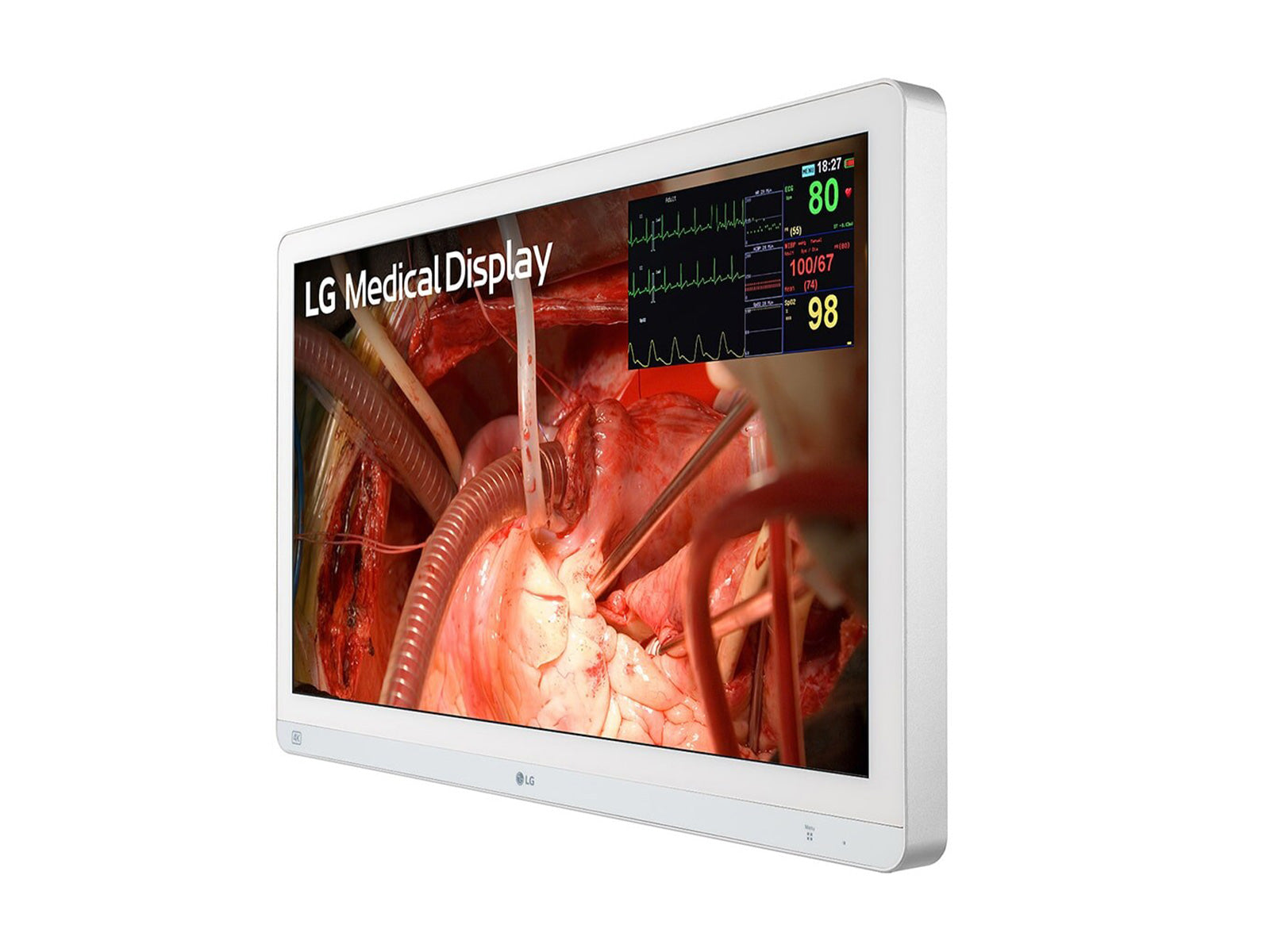 Monitor Médico LG 27HQ710S-W 27" – Uso Quirúrgico (2)