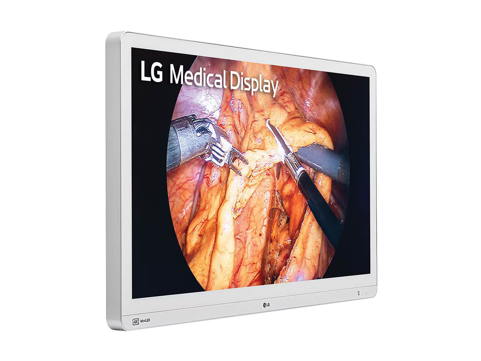 Monitor Médico LG 32HR734S-W 8MP – 31.5" – Uso Quirúrgico (2)