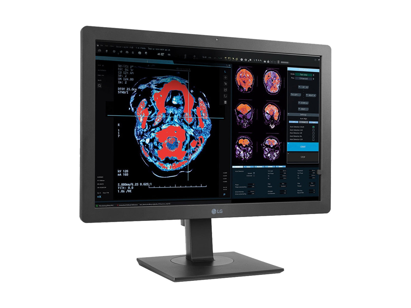Monitor Médico LG 24HR513C-B 2MP – 24" – Radiología Diagnóstica DICOM (7)