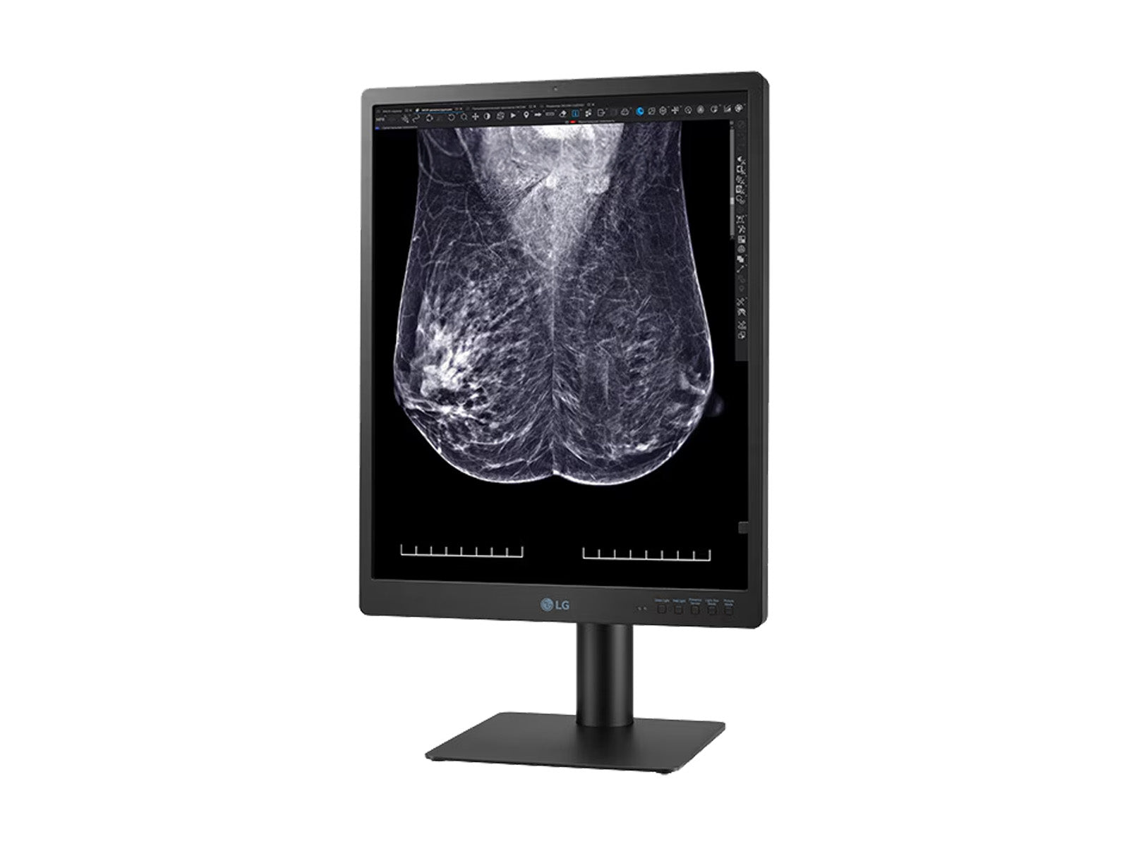 Monitor Médico LG 21HQ613D-B 5MP – 21" – Color – Radiología Diagnóstica DICOM (8)