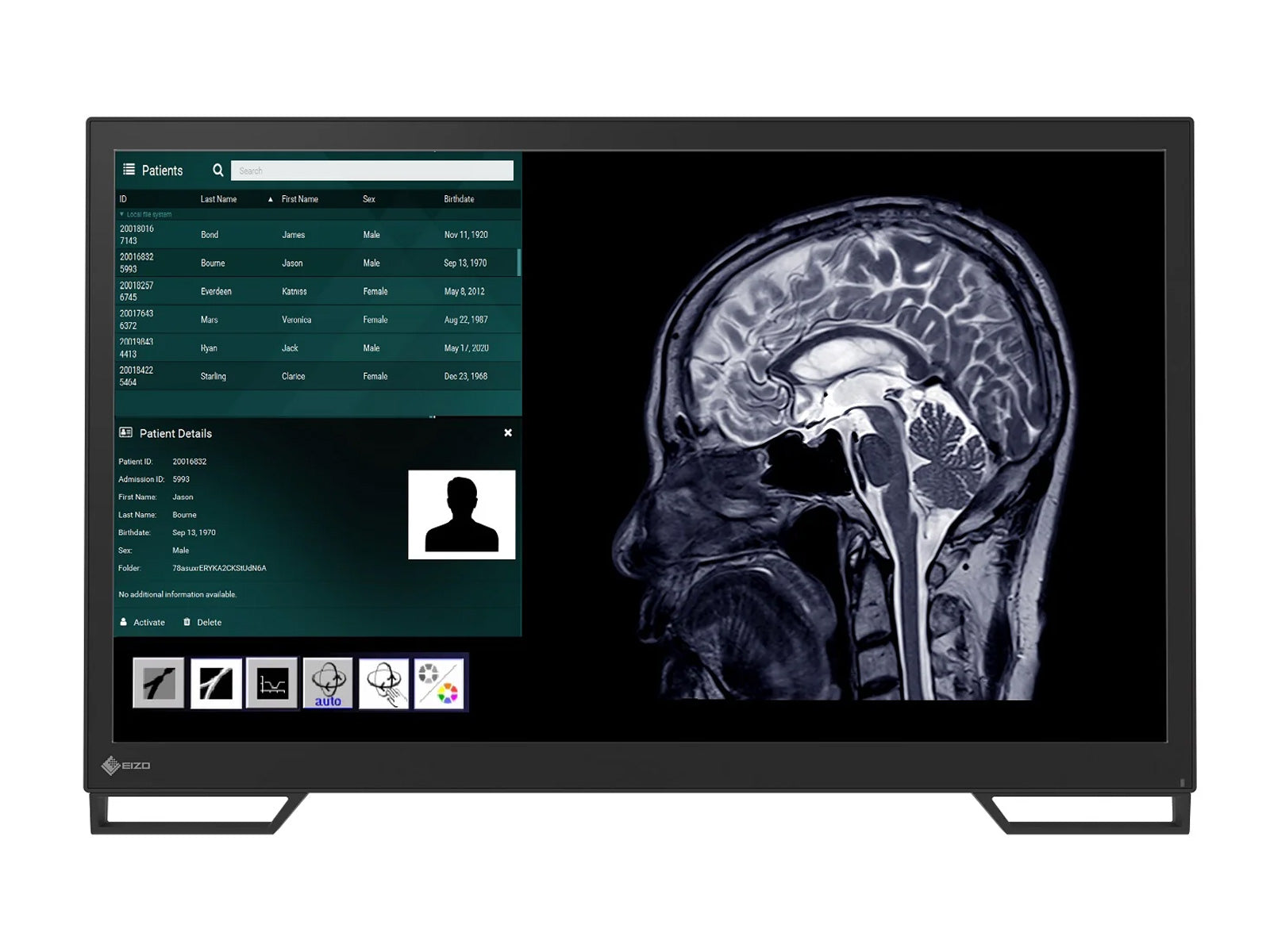 Monitor Médico Eizo LX2420-T – Uso Quirúrgico DICOM (1)