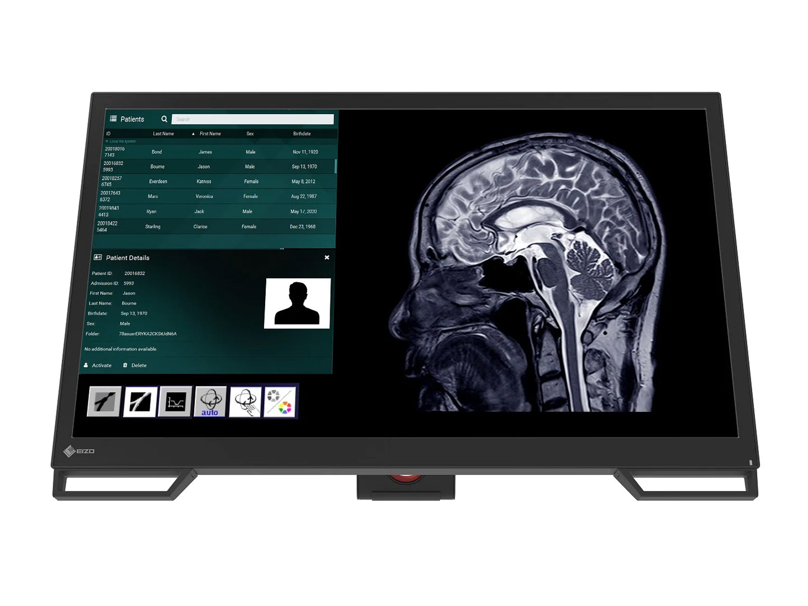 Monitor Médico Eizo LX2420-T – Uso Quirúrgico DICOM (2)