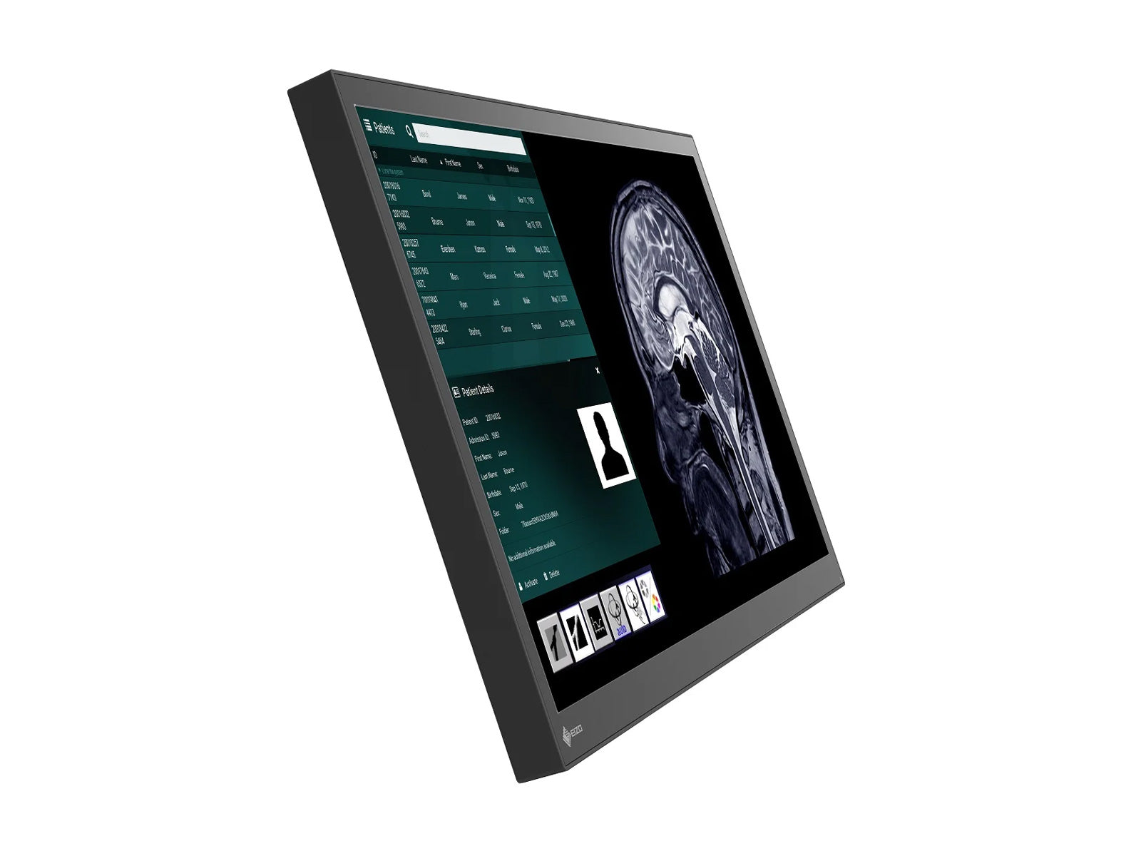 Monitor Médico Eizo LX2420-T – Uso Quirúrgico DICOM (3)