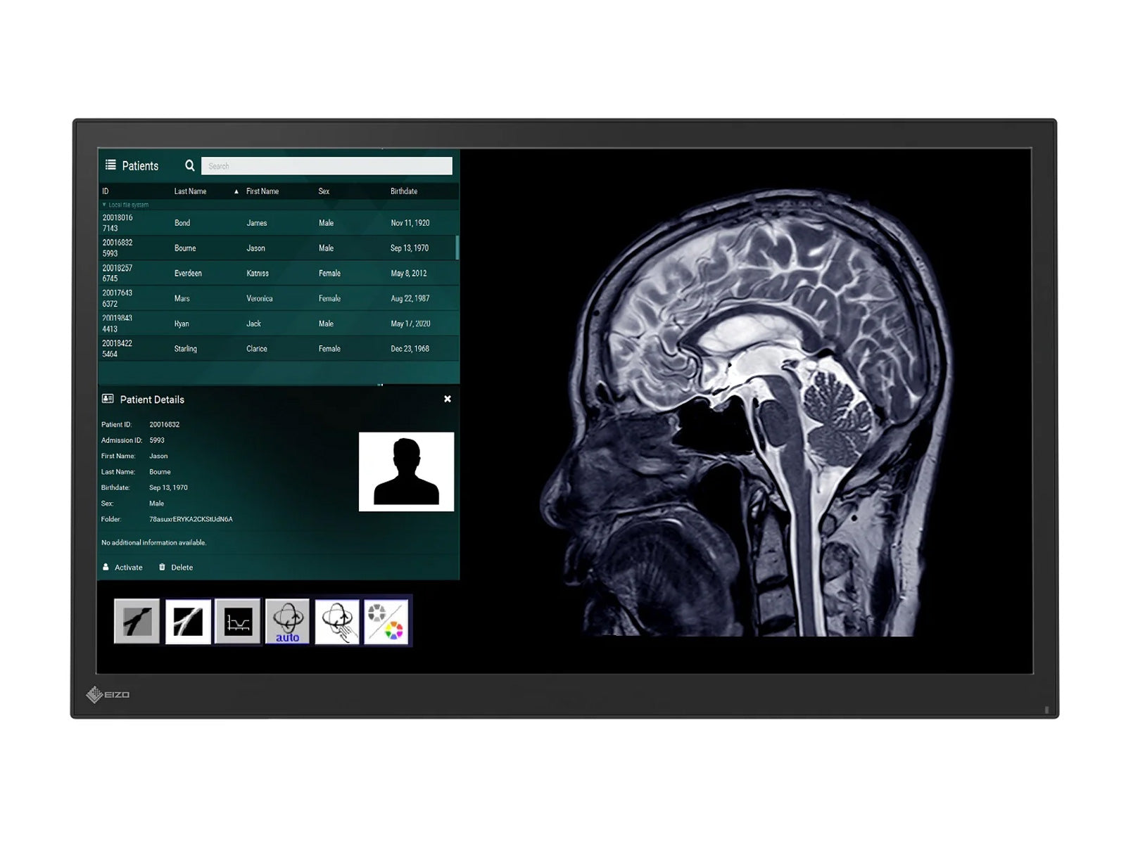 Monitor Médico Eizo LX2420-T – Uso Quirúrgico DICOM (4)